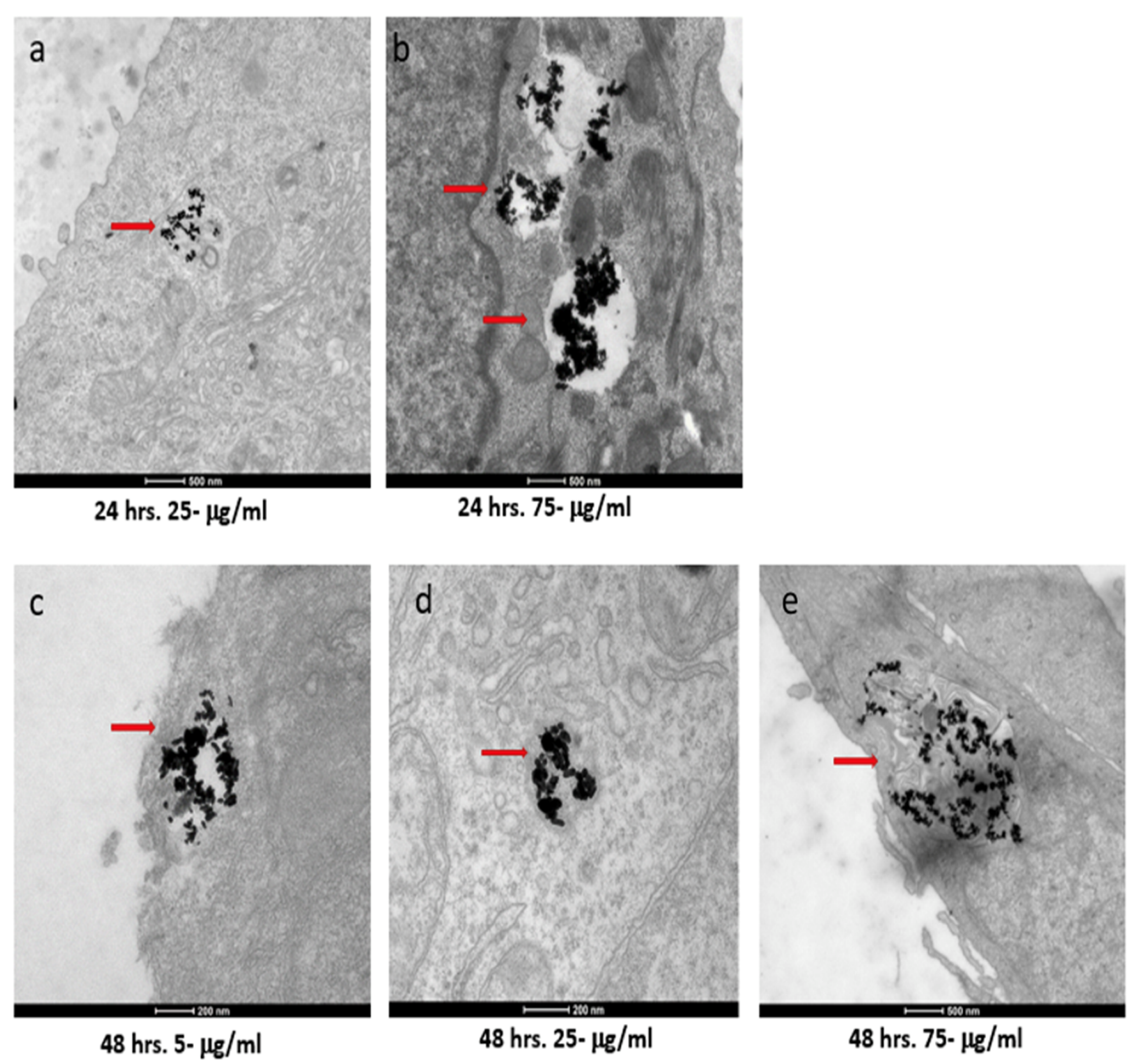 Nanomaterials 12 00937 g005