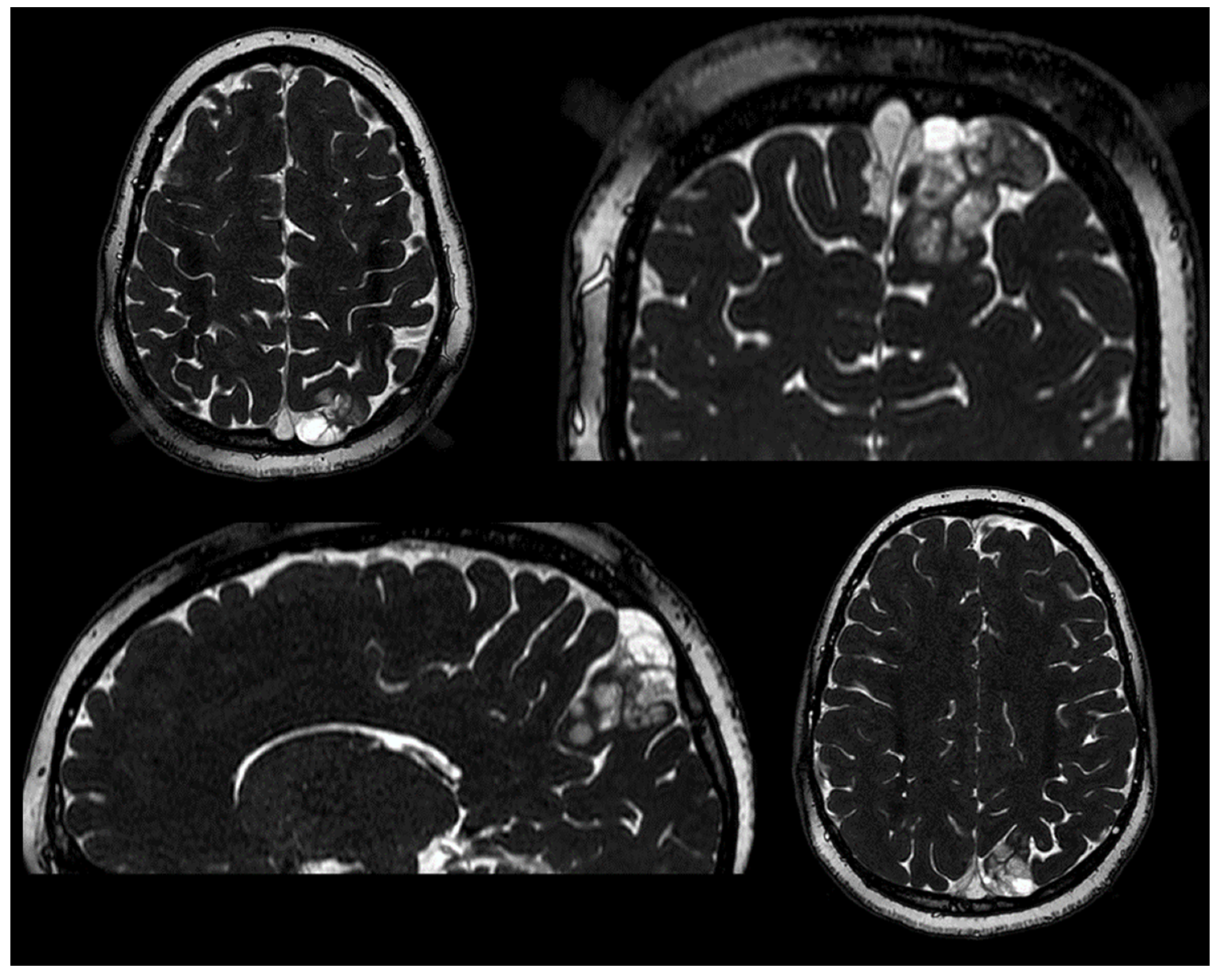 Neuroglia 05 00013 g001 Neuroglia 05 00013 g001