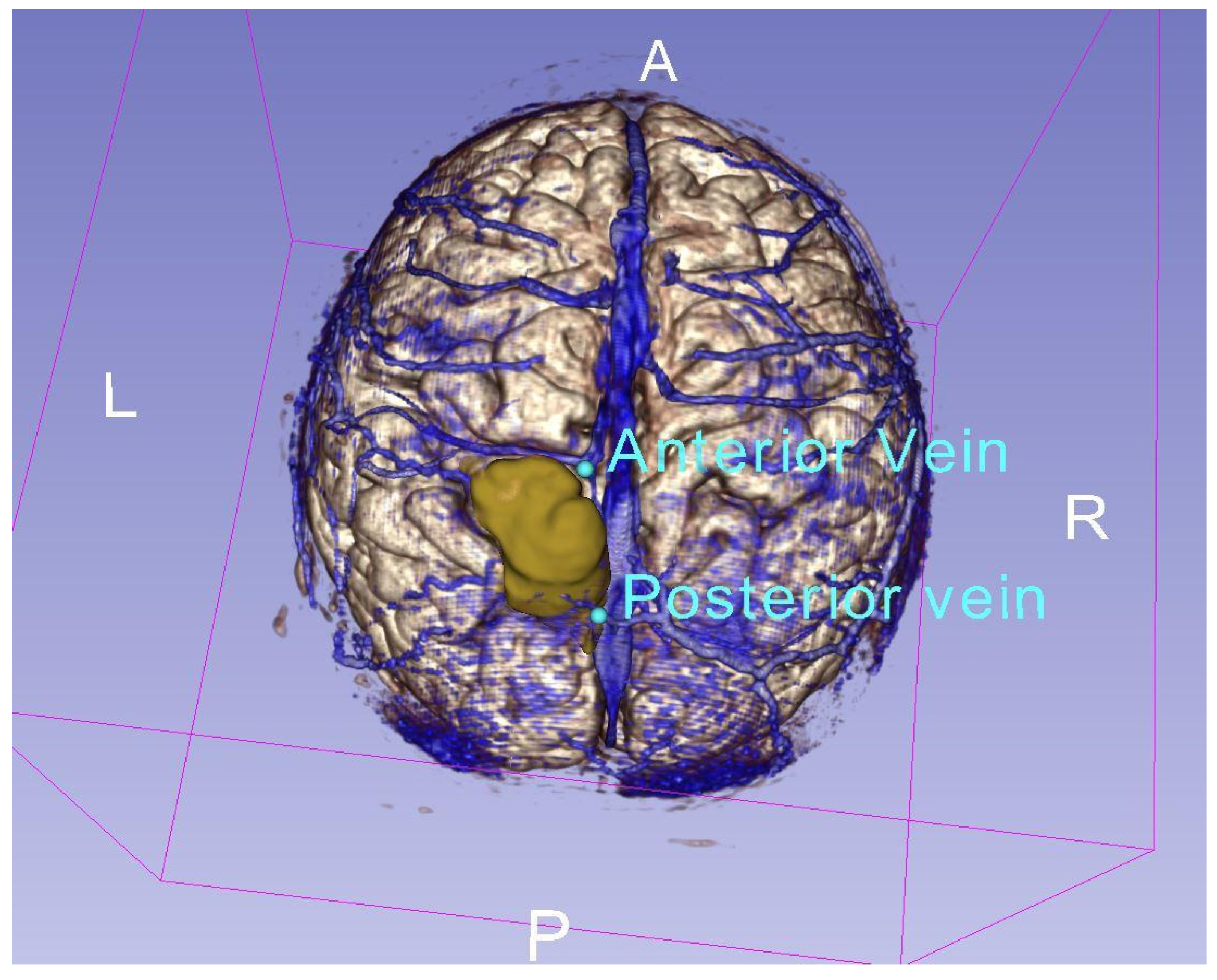 Neuroglia 05 00013 g002 Neuroglia 05 00013 g002