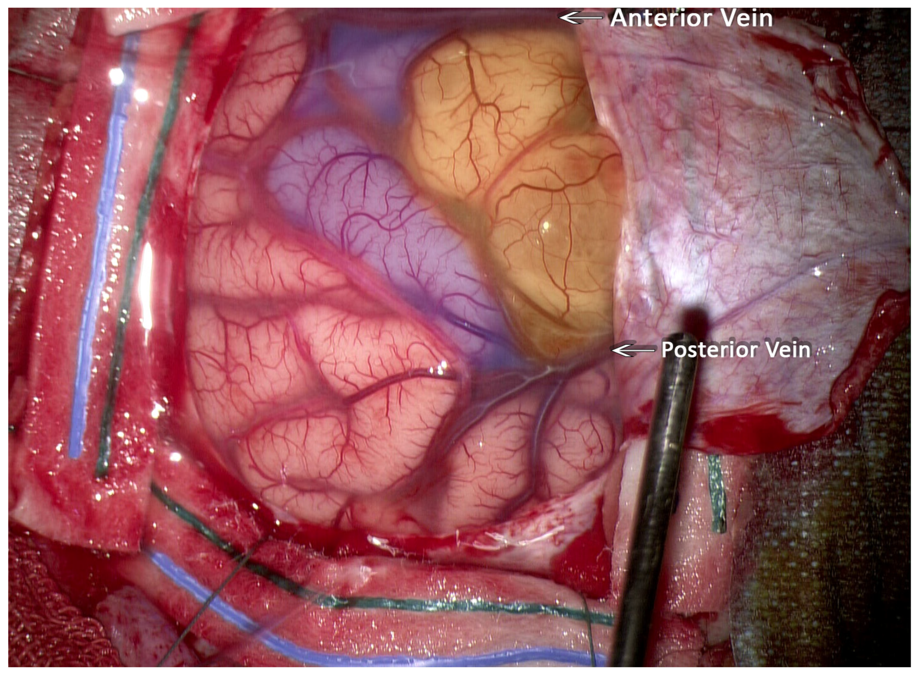 Neuroglia 05 00013 g003 Neuroglia 05 00013 g003
