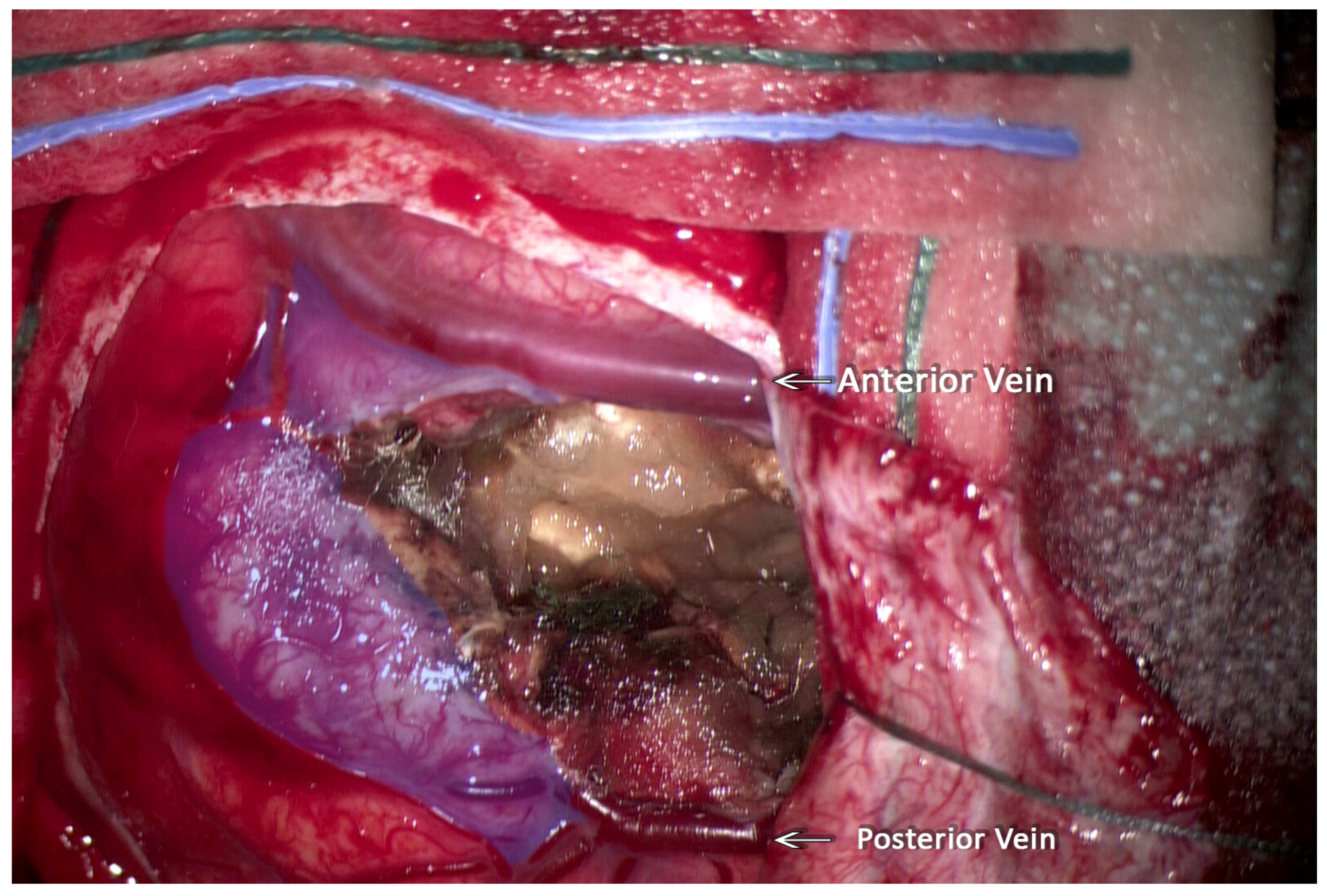 Neuroglia 05 00013 g004 Neuroglia 05 00013 g004