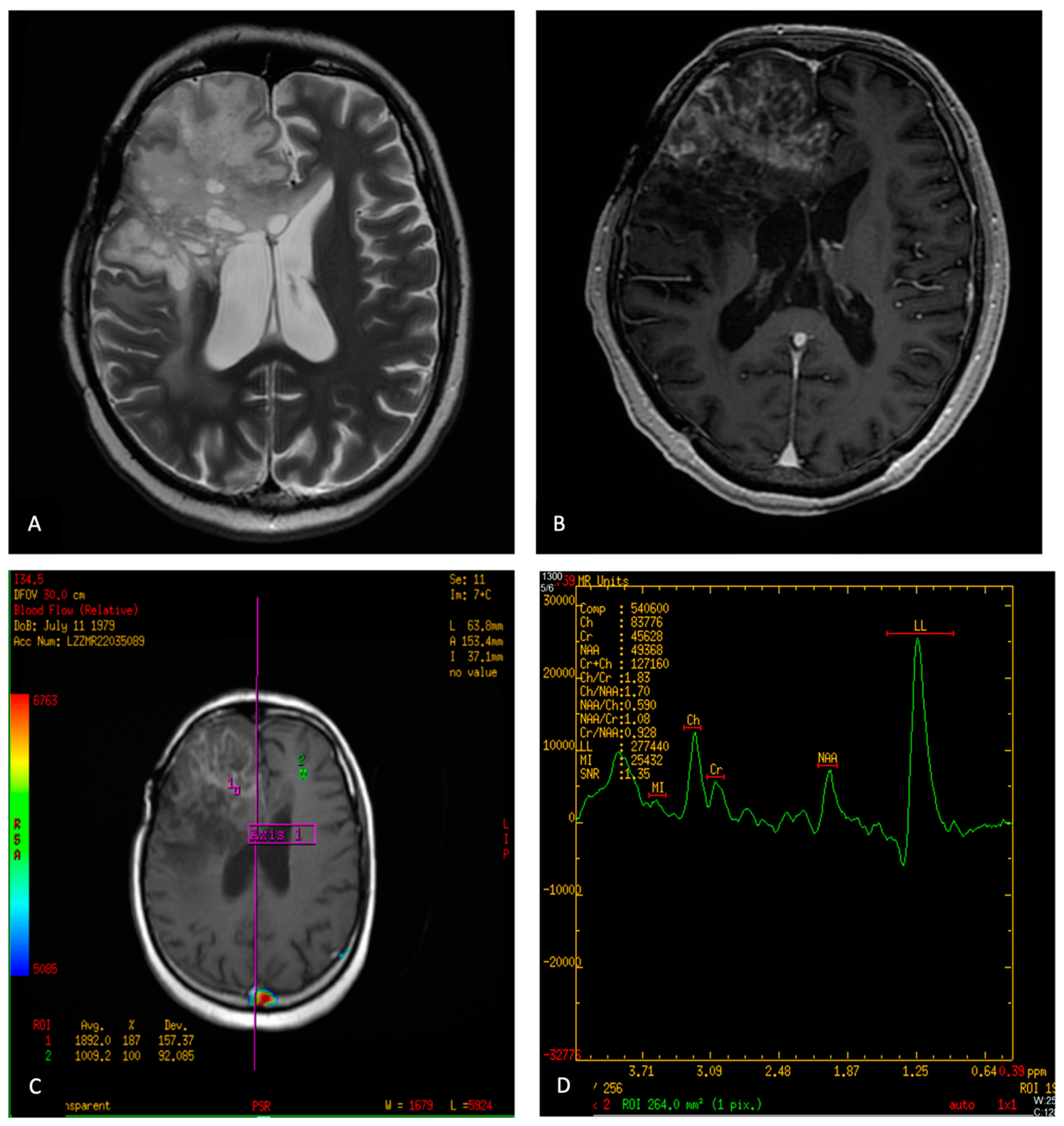 Neuroglia 05 00025 g004