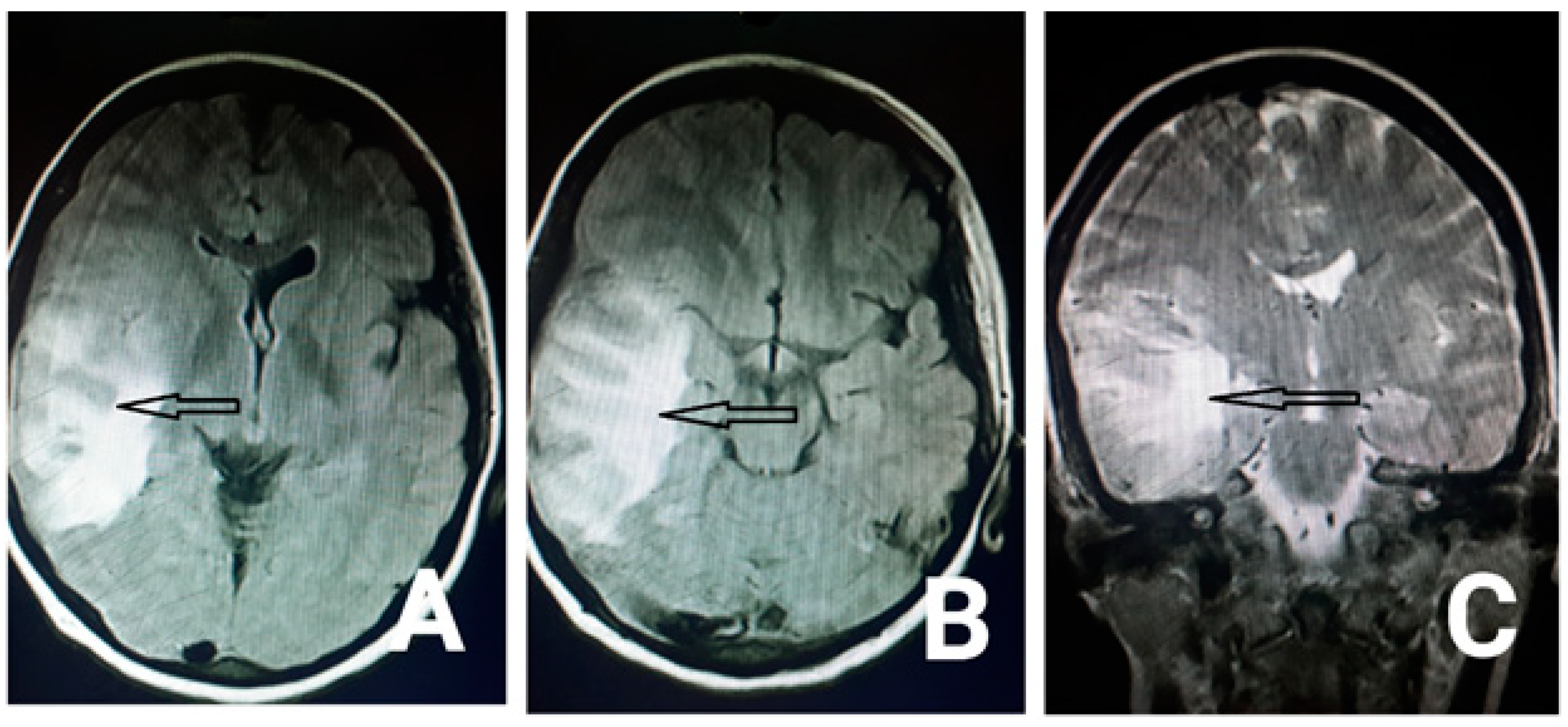 Neurolint 13 00011 g002 Neurolint 13 00011 g002