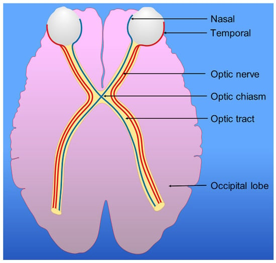 Neurology International | Free Full-Text | Mild-to-Moderate Traumatic ...