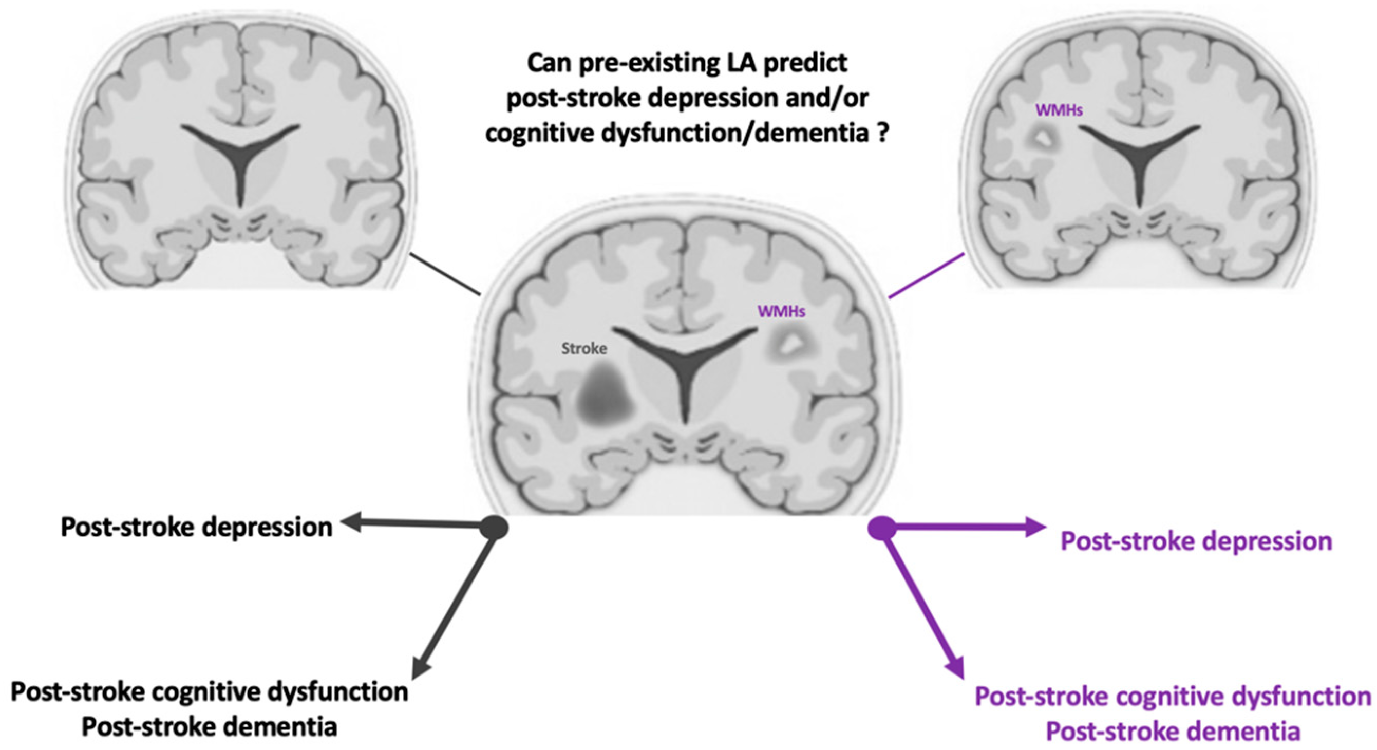 PDF) Post-Stroke Apathy: An Exploratory Longitudinal Study