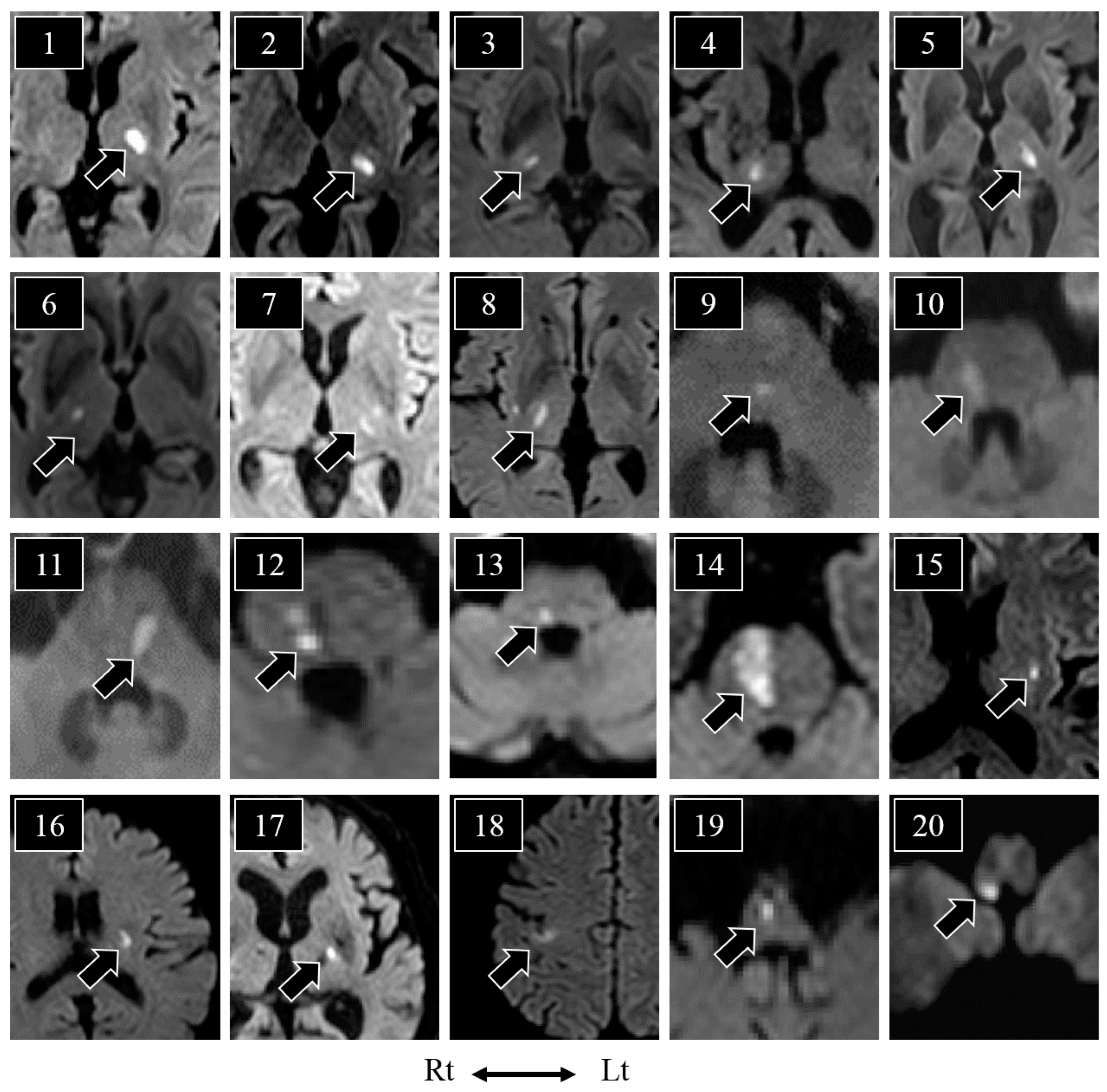 Neurolint 15 00030 g002 Neurolint 15 00030 g002