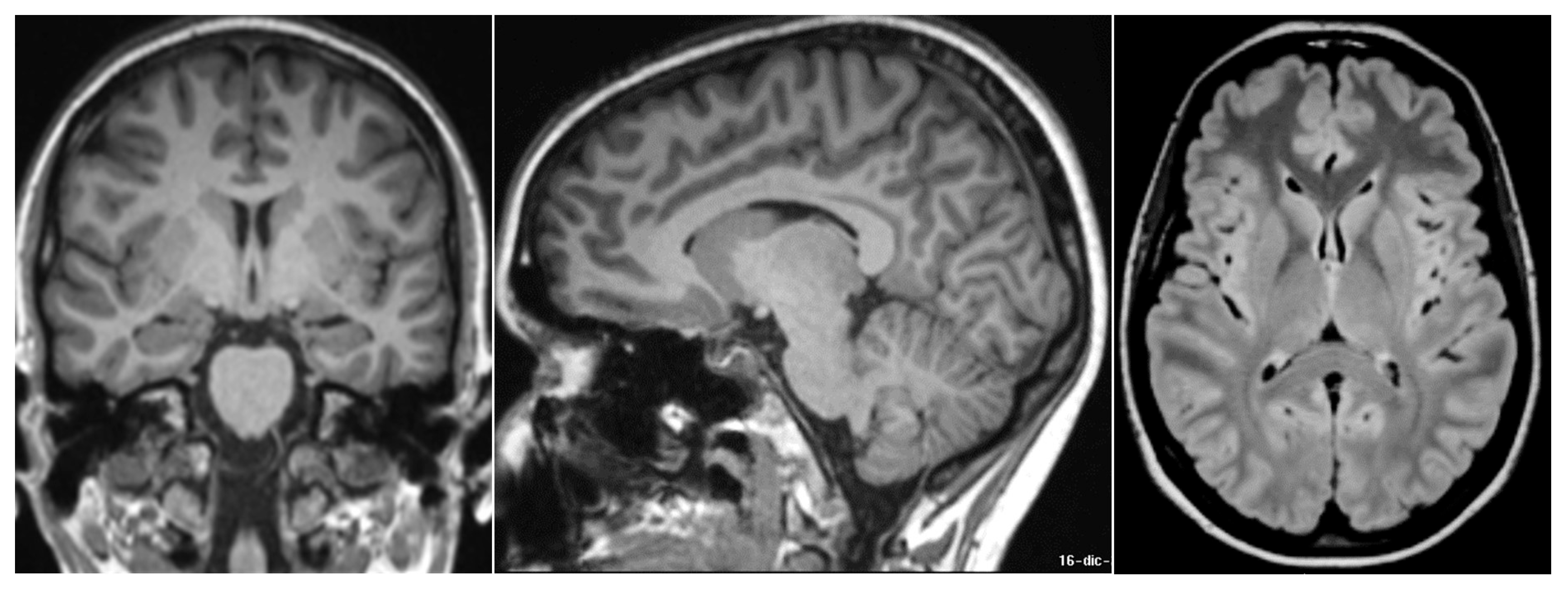 Neurolint 15 00058 g001 Neurolint 15 00058 g001