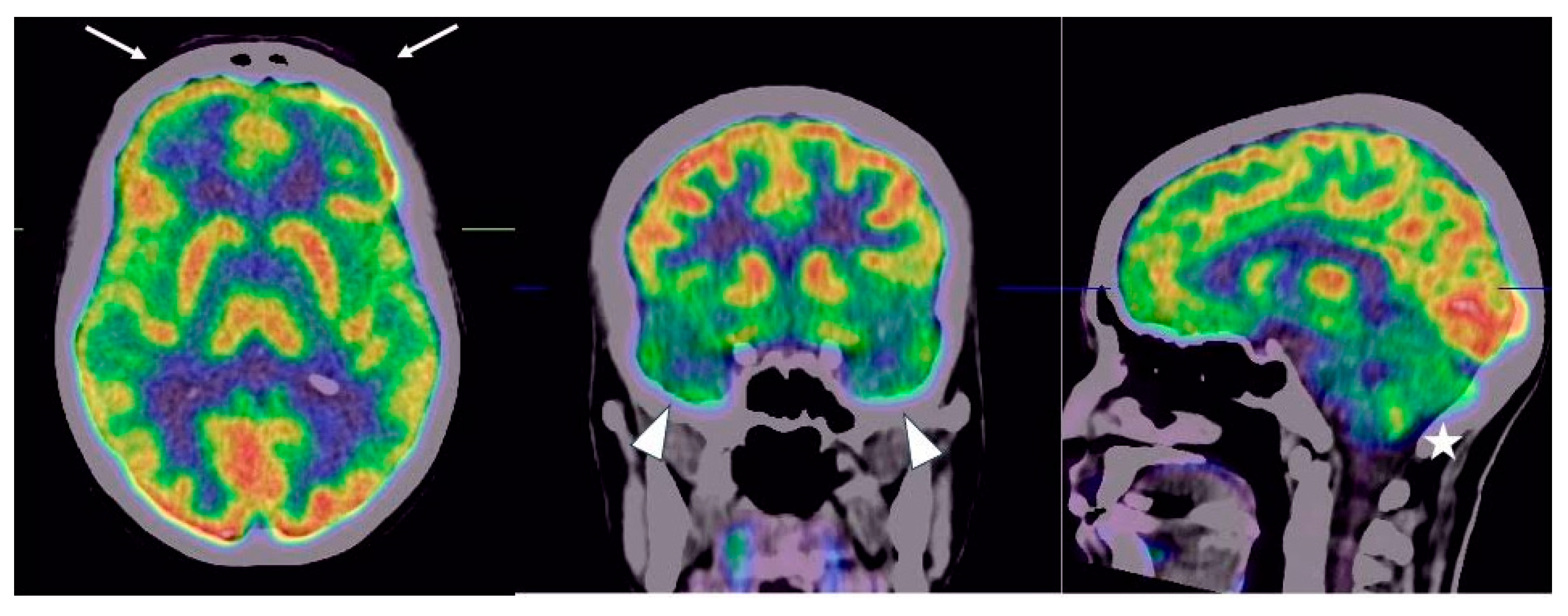 Neurolint 15 00058 g003 Neurolint 15 00058 g003