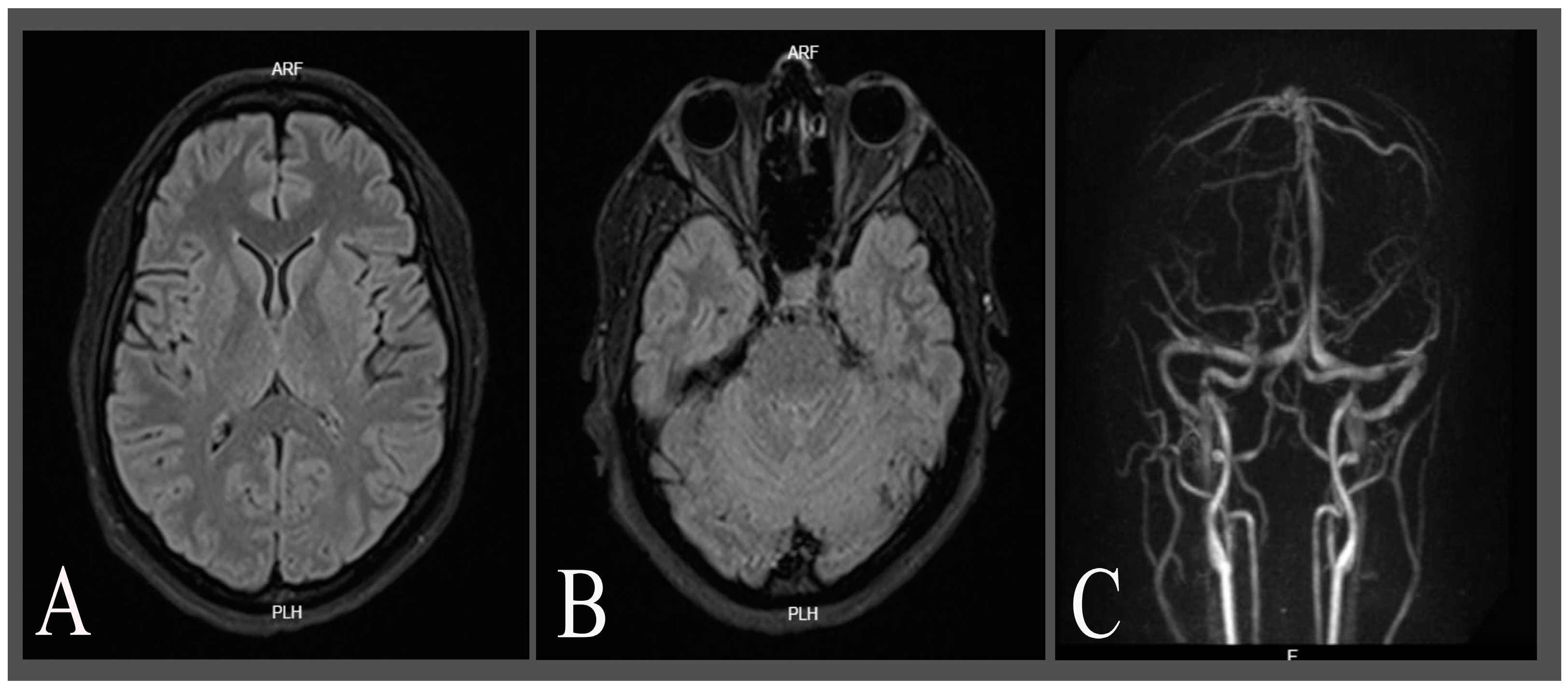 Neurolint 16 00128 g001