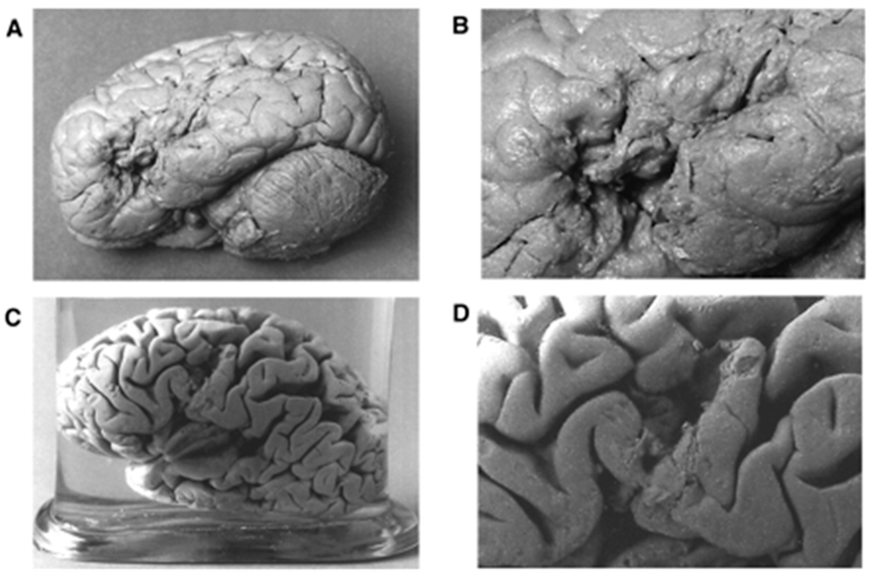 Neurosci 03 00037 g003