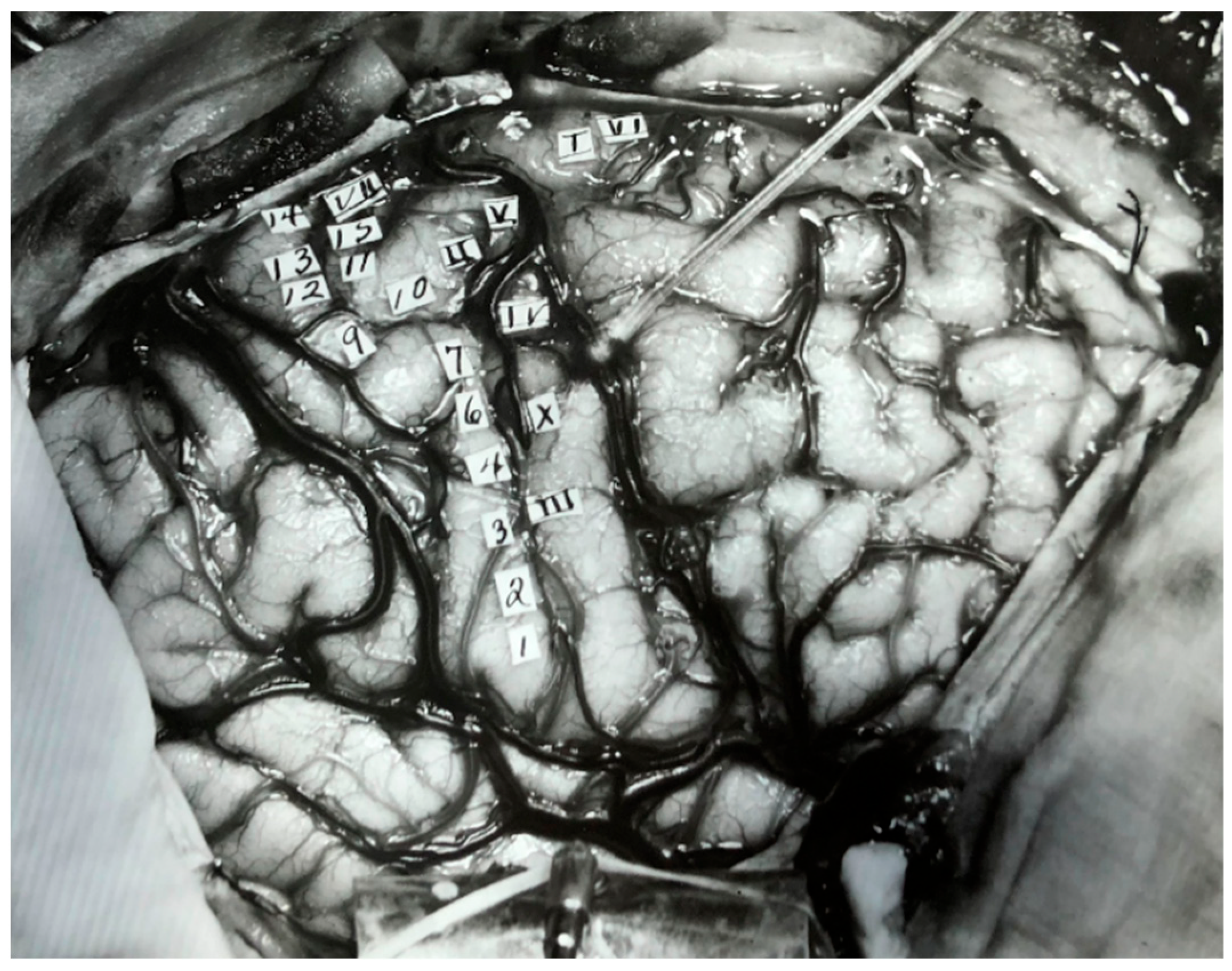 Neurosci 03 00037 g004