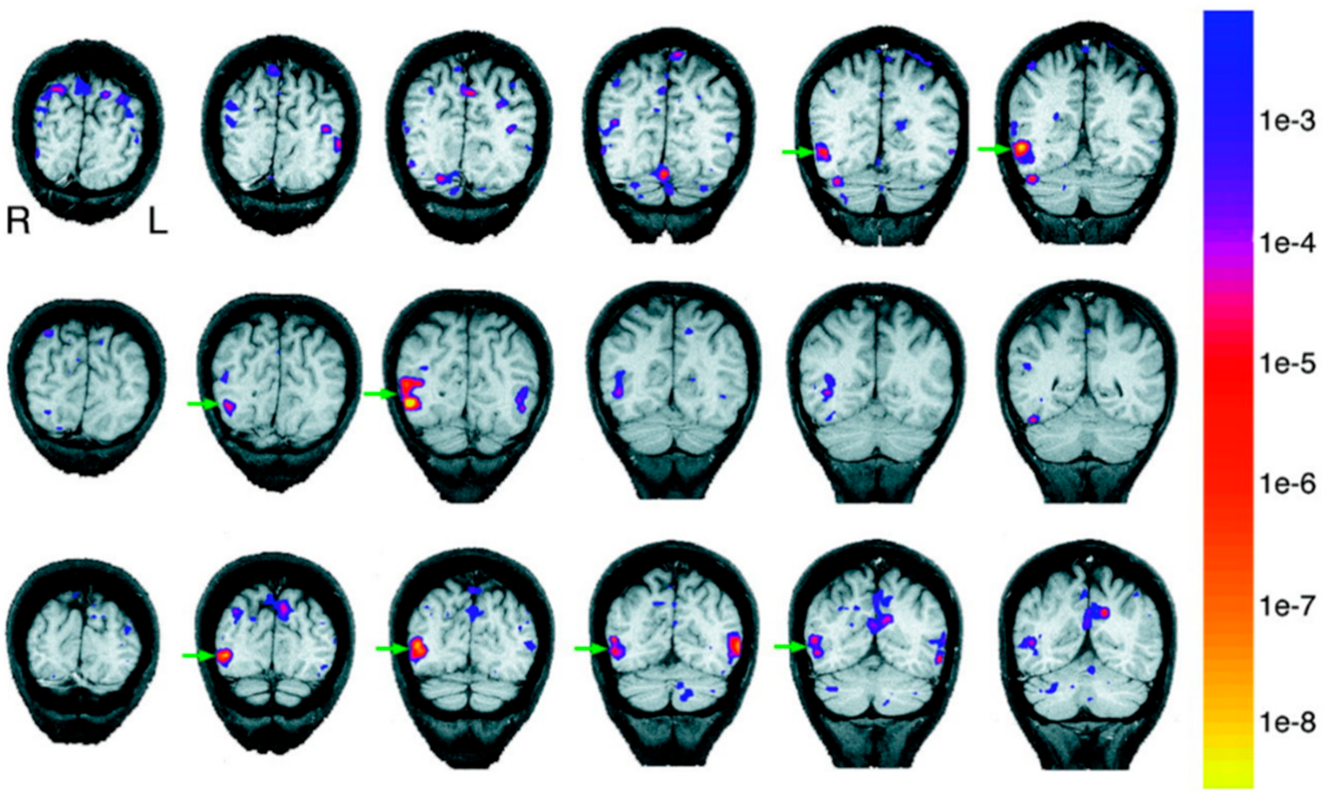 Neurosci 03 00037 g006