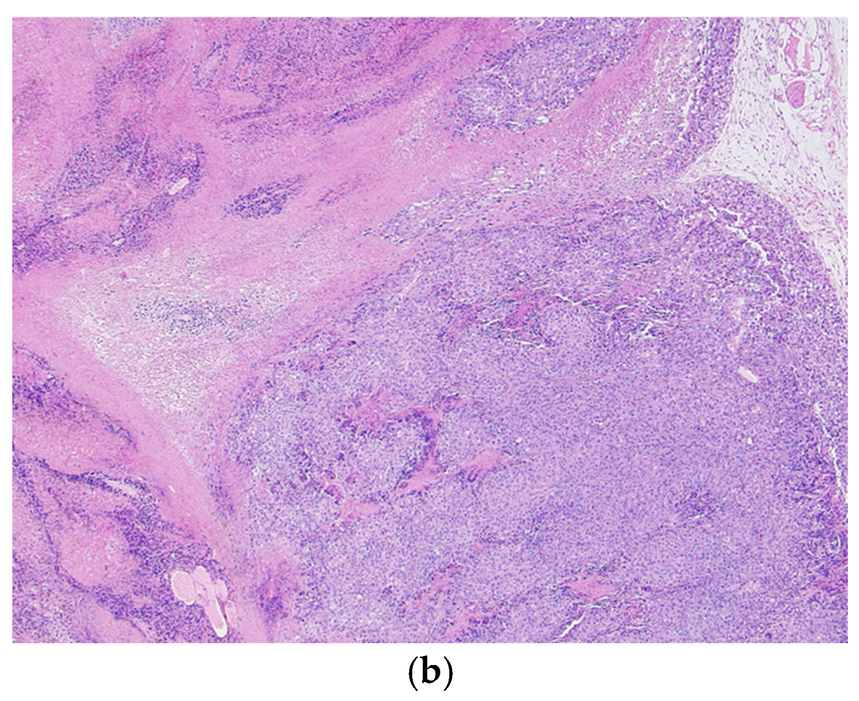 Nutraceuticals 05 00004 g004b