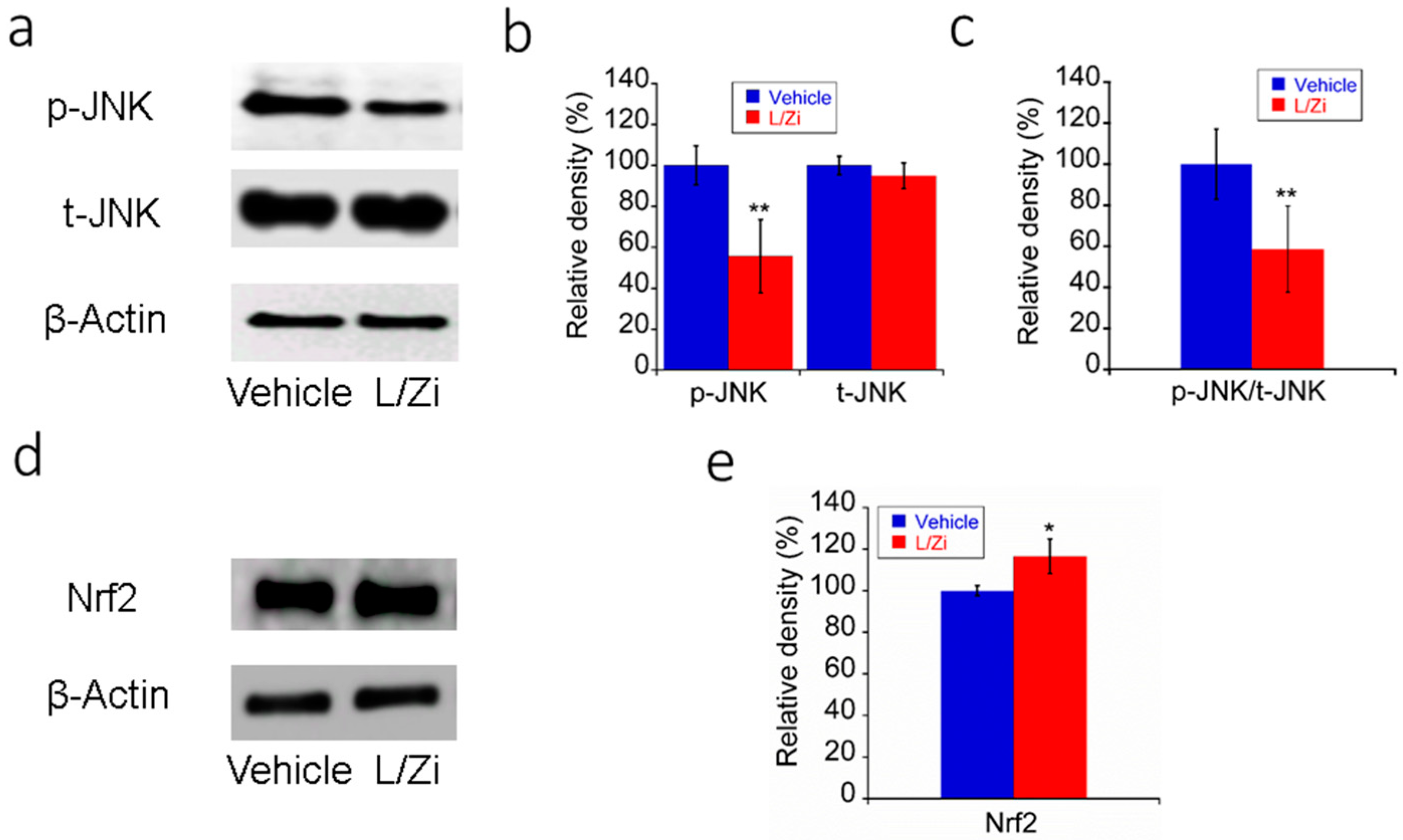 Nutrients Free Full Text Lutein And Zeaxanthin Isomers Protect Against Light Induced Retinopathy Via Decreasing Oxidative And Endoplasmic Reticulum Stress In Balb Cj Mice Html