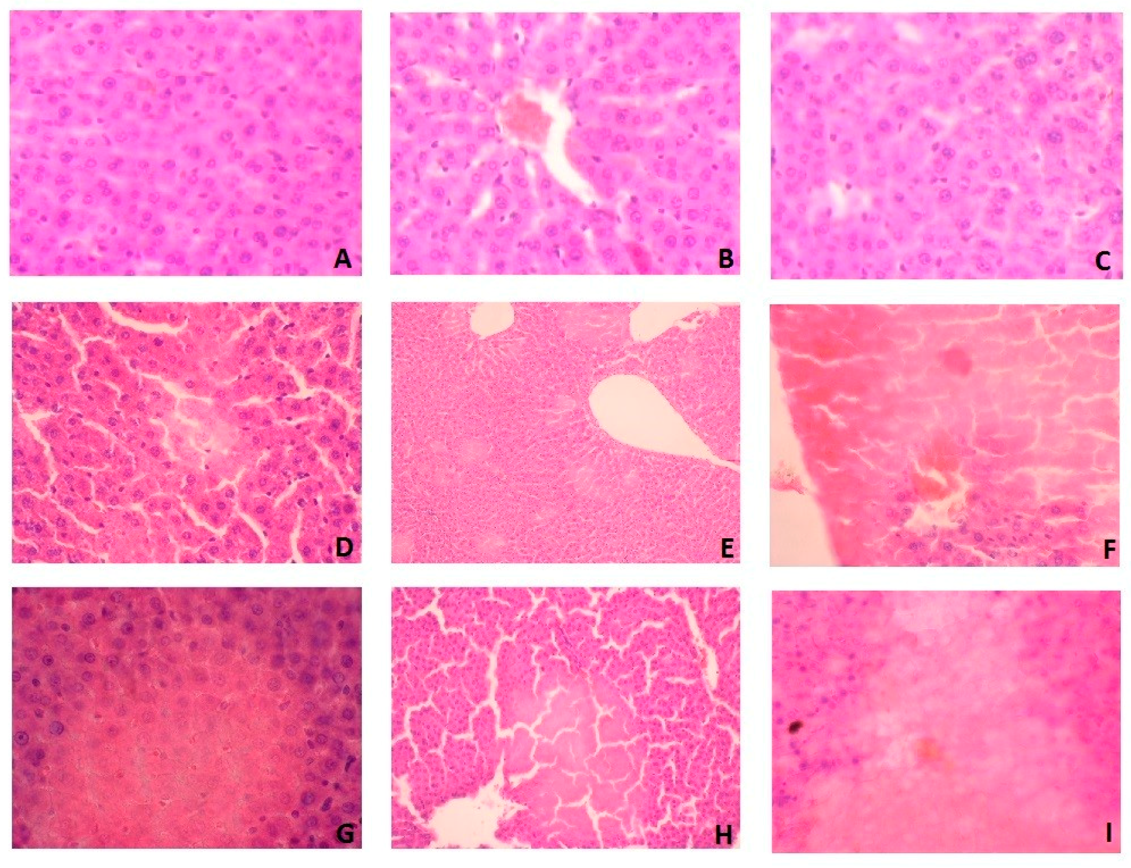 Nutrients Free Full Text Whey Protein Concentrate Wpc 80 Intensifies Glycoconjugate Catabolism And Induces Oxidative Stress In The Liver Of Rats Html