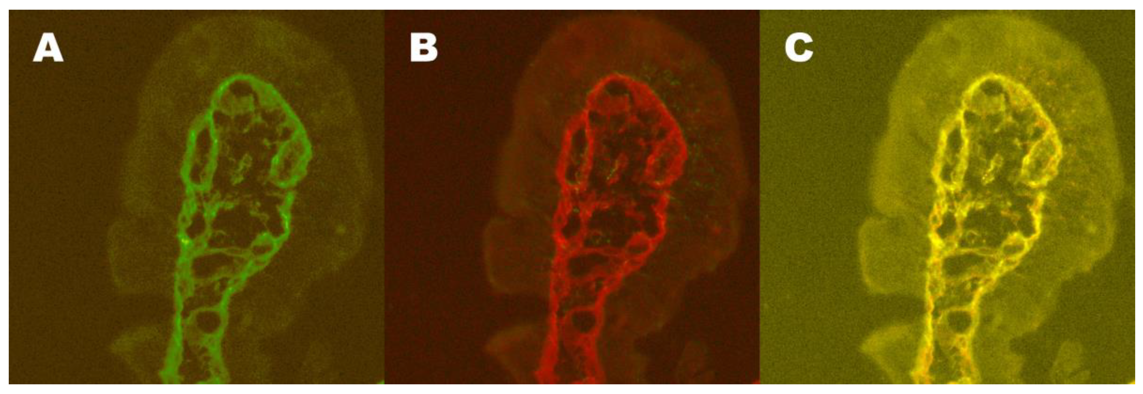 Nutrients Free Full Text Gluten Induced Extra Intestinal Manifestations In Potential Celiac 