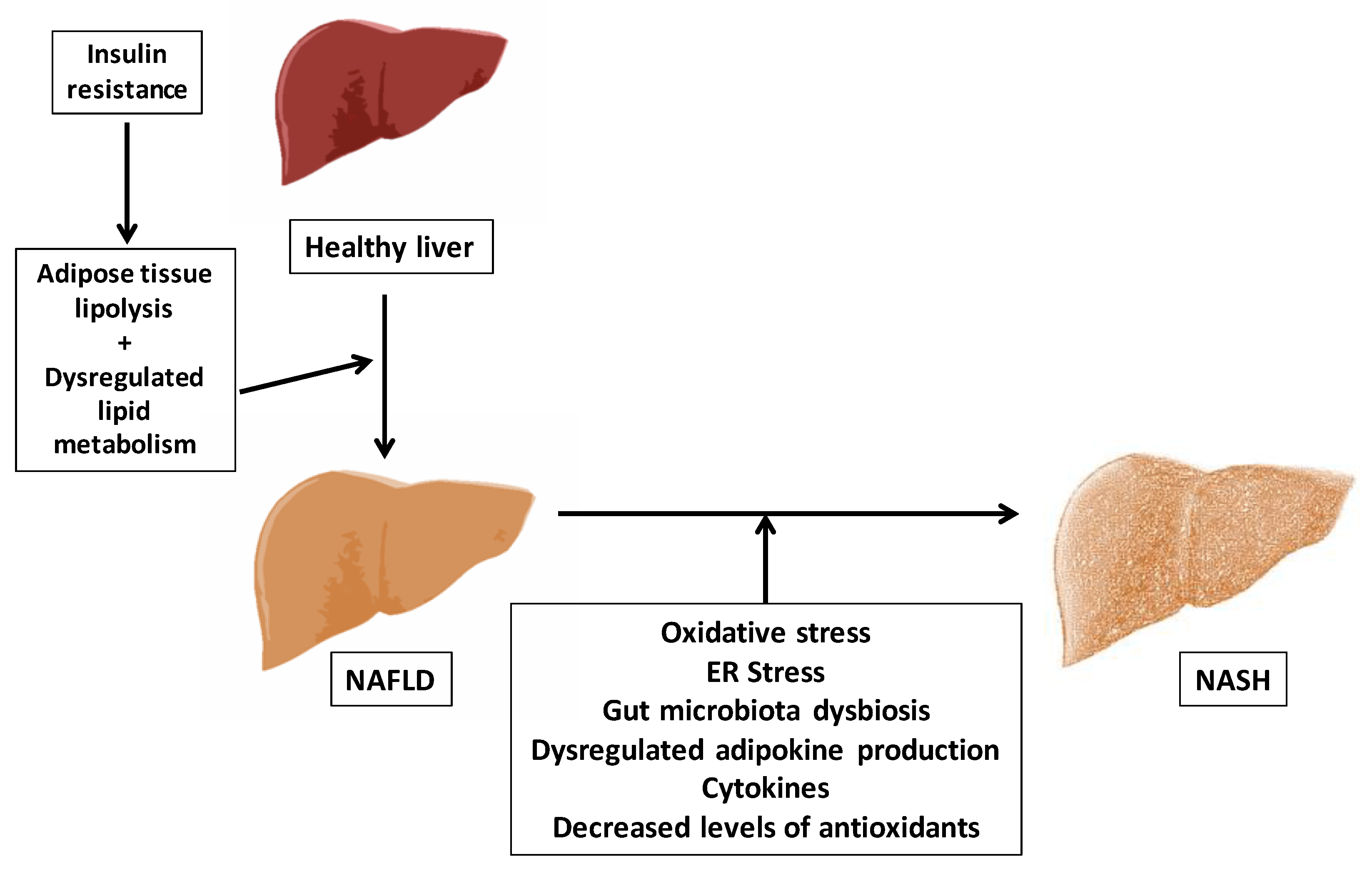 Nutrients | Free Full-Text | Oxidative Stress and Non-Alcoholic Fatty Liver  Disease: Effects of Omega-3 Fatty Acid Supplementation