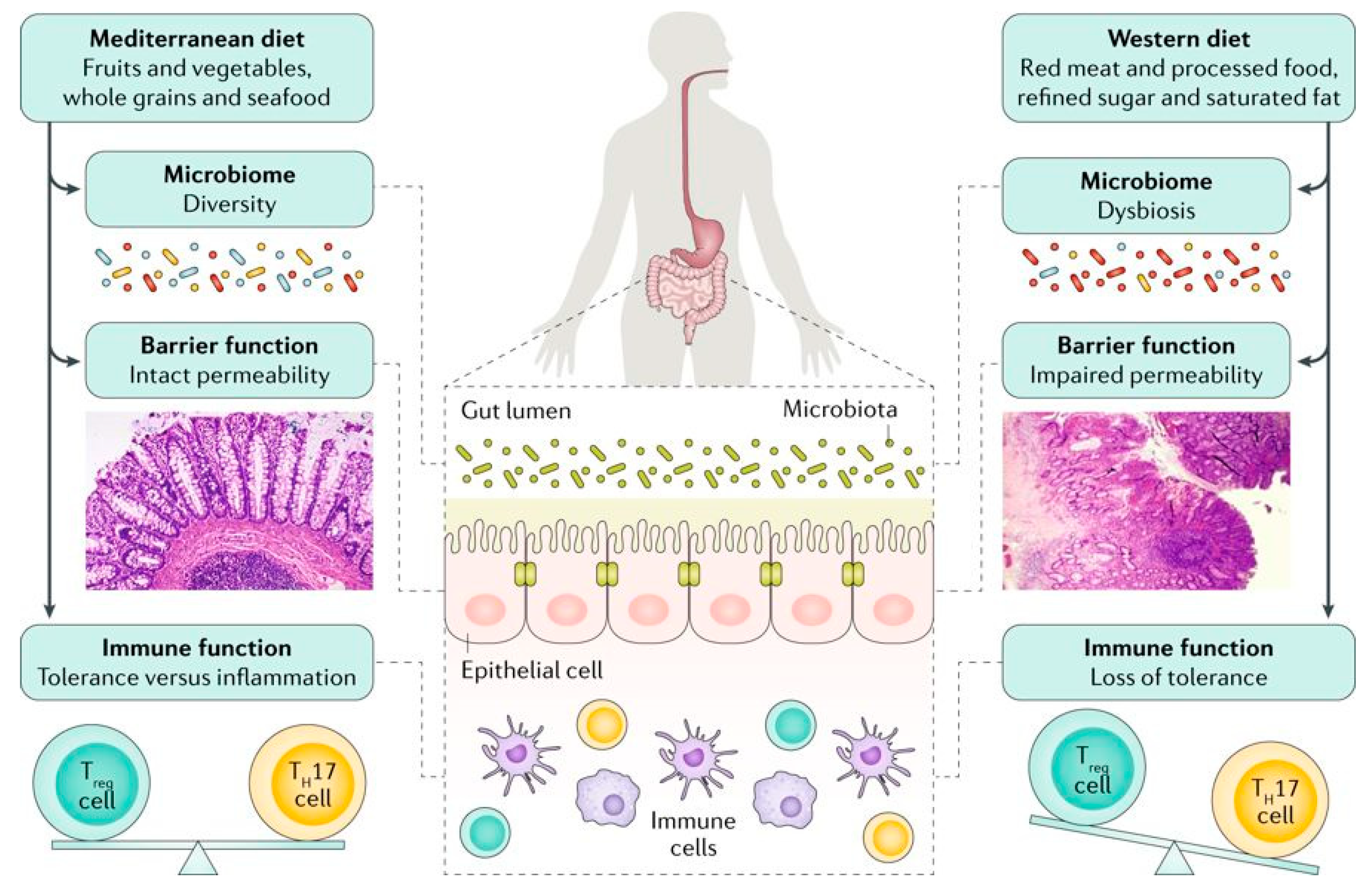 Nutrients | Free Full-Text | Diet in the Pathogenesis and Management of Ulcerative  Colitis; A Review of Randomized Controlled Dietary Interventions