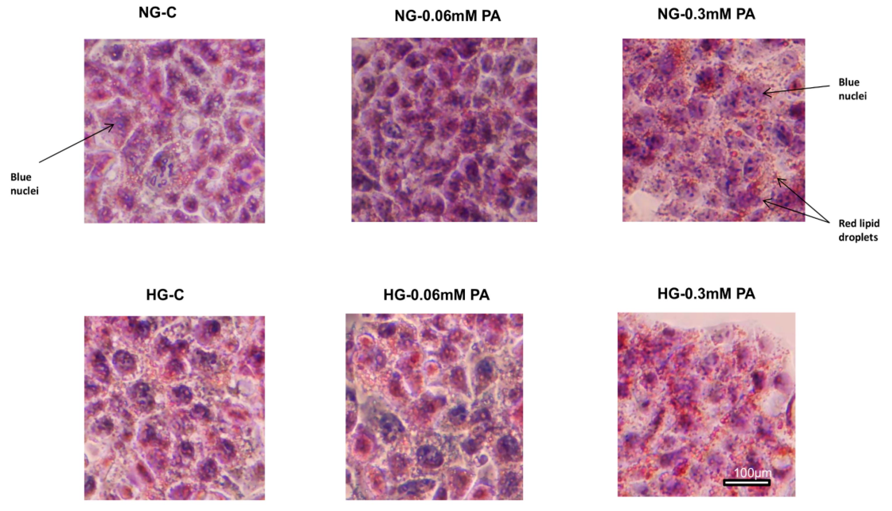 Nutrients 11 01979 g011 Nutrients 11 01979 g011