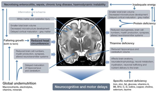 Nutrients | Free Full-Text | The Influence of Early Nutrition on Brain ...