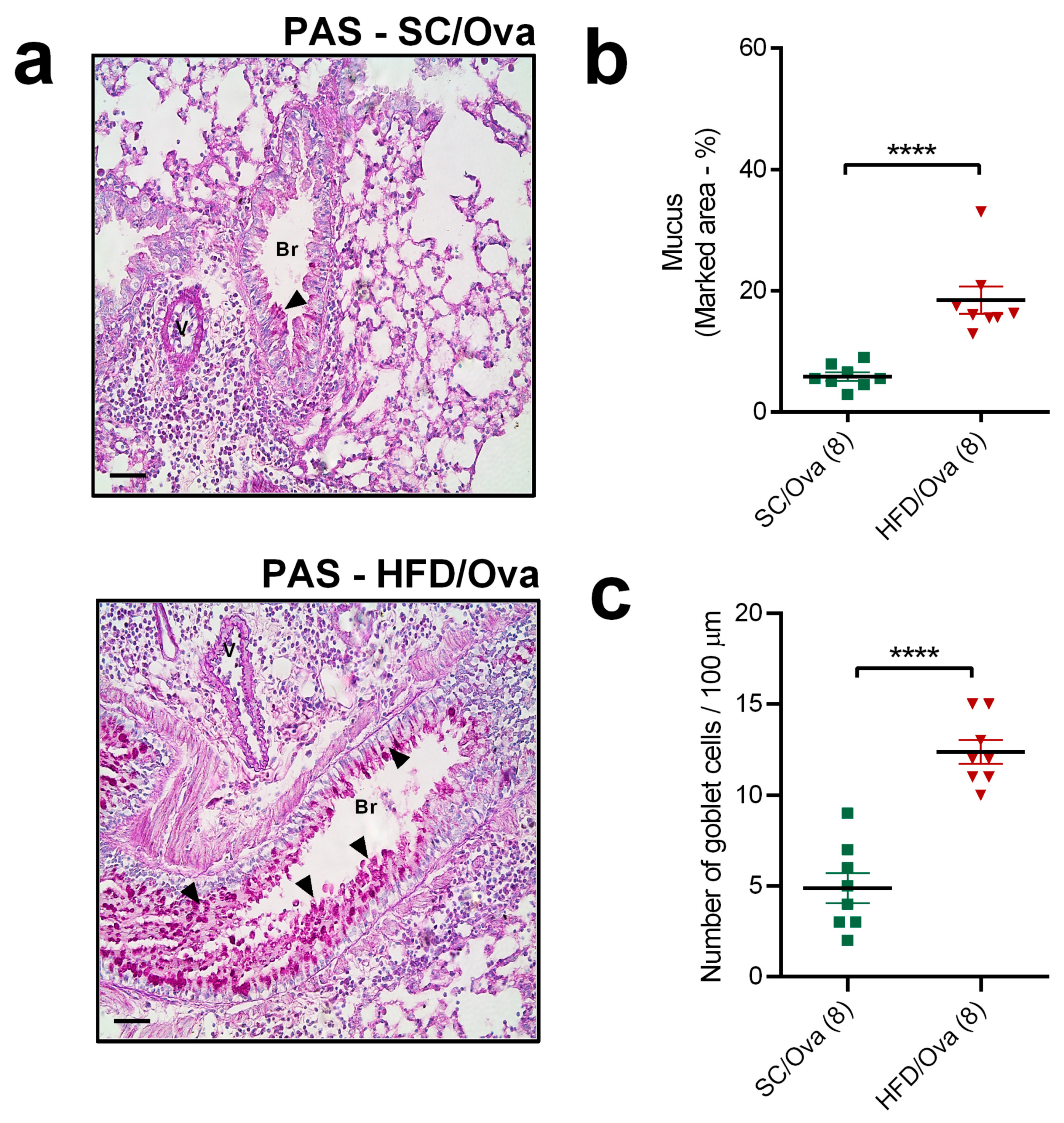 Nutrients 11 02902 g005