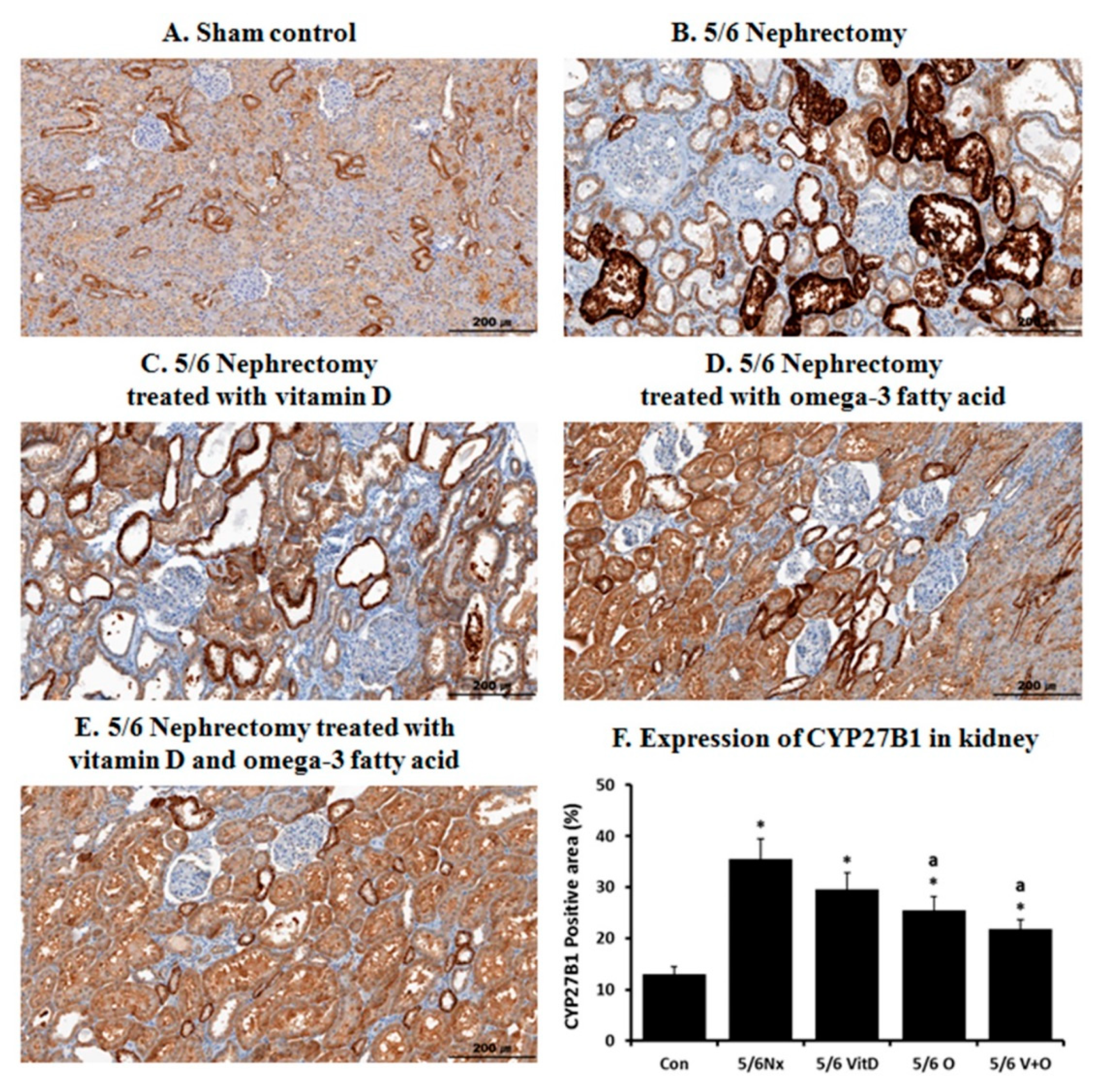 Nutrients Free Full Text Combined Treatment With Omega 3 Fatty Acid And Cholecalciferol Increases 1 25 Dihydroxyvitamin D Levels By Modulating Dysregulation Of Vitamin D Metabolism In 5 6 Nephrectomy Rats Html