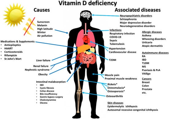 Nutrients | Free Full-Text | Immunologic Effects of Vitamin D on Human  Health and Disease