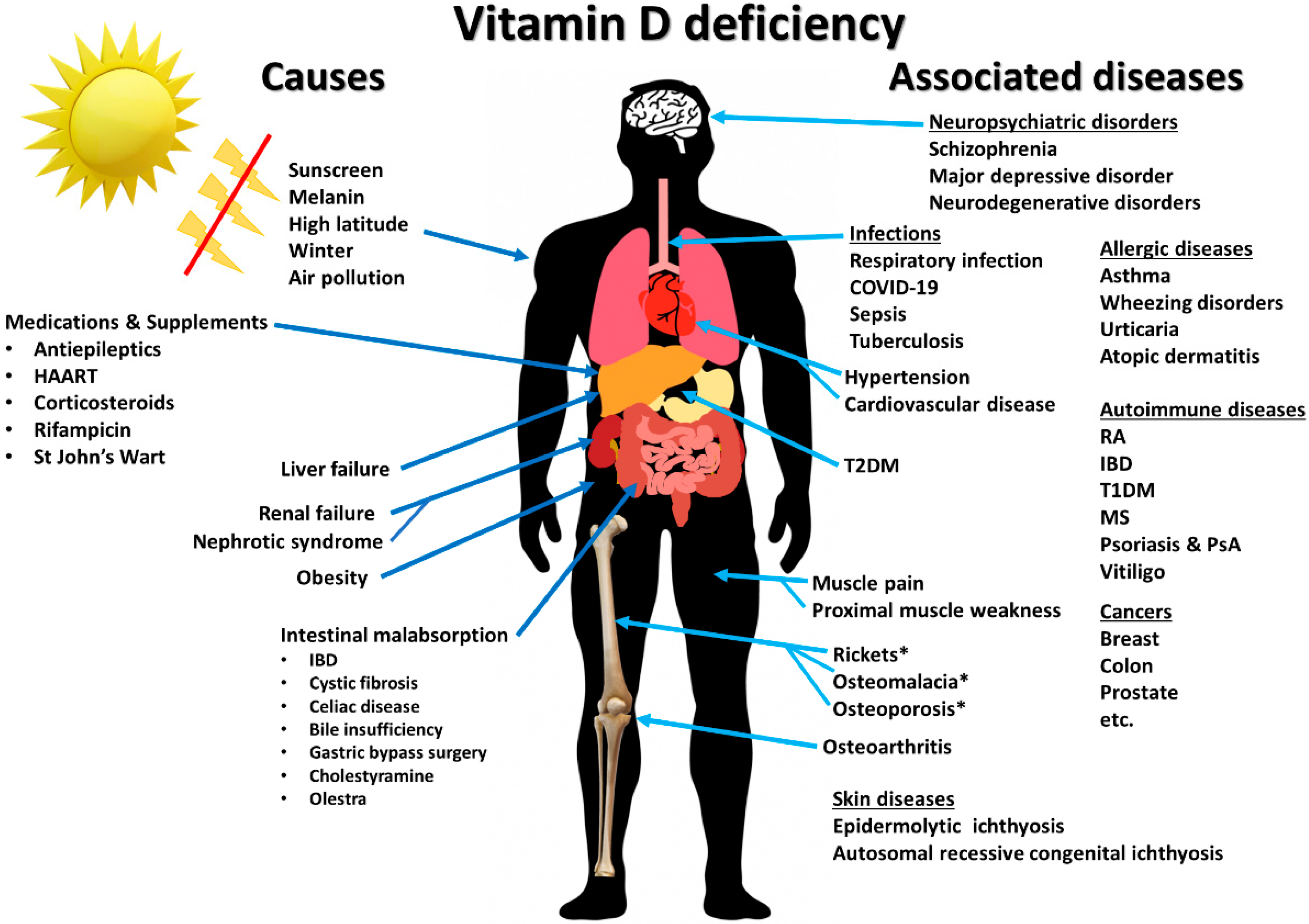 Nutrients | Free Full-Text | Immunologic Effects of Vitamin D on Human  Health and Disease