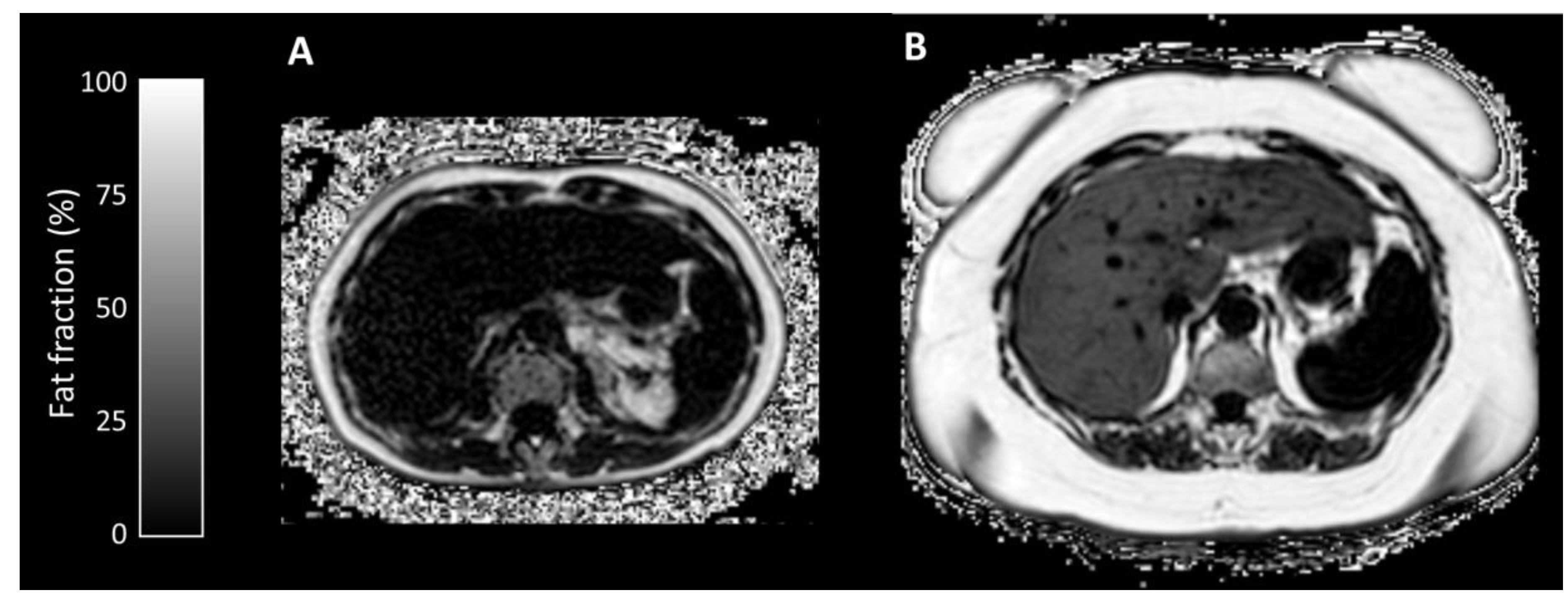 Nutrients 12 02151 g003 Nutrients 12 02151 g003