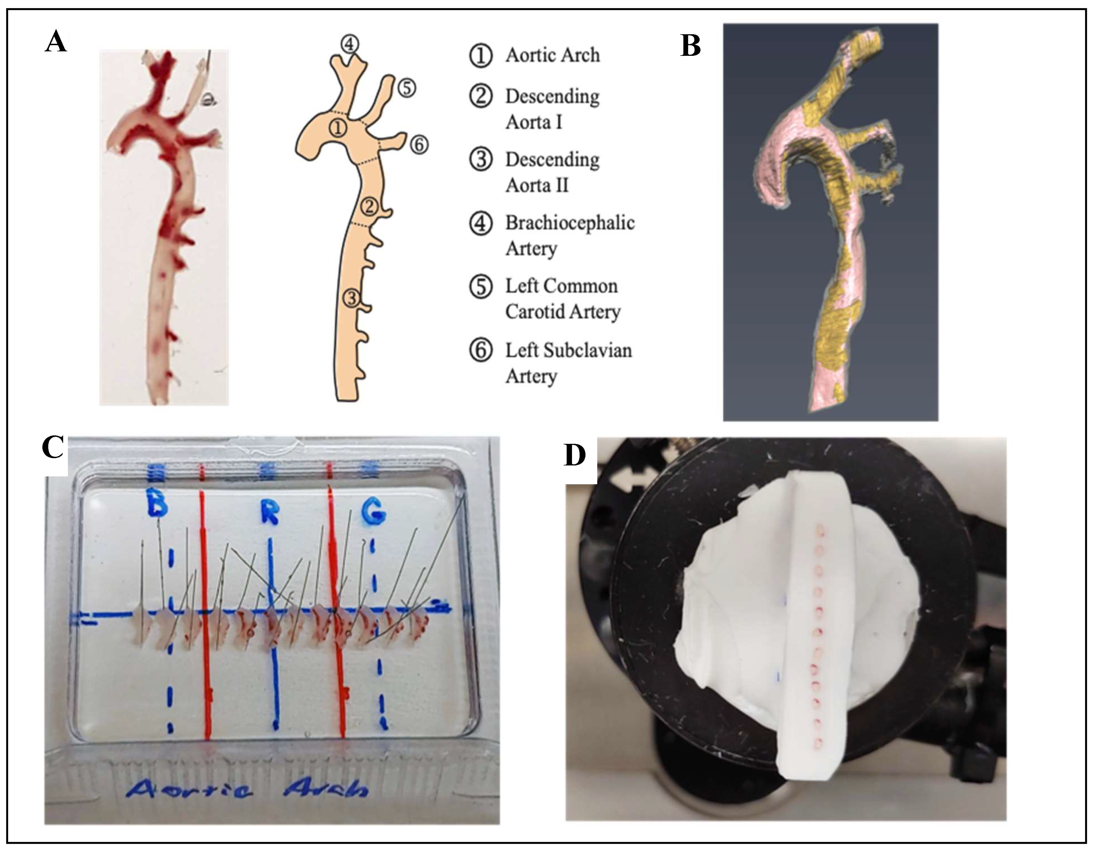 Nutrients Free Full Text No Effect Of Diet Induced Mild Hyperhomocysteinemia On Vascular Methylating Capacity Atherosclerosis Progression And Specific Histone Methylation Html