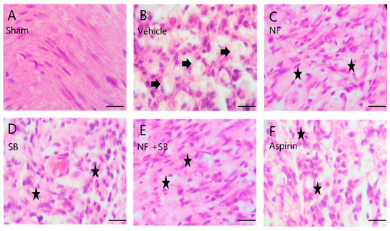 Nutrients Free Full Text Neuroprotective Effect Of Nypa Fruticans Wurmb By Suppressing Trpv1 Following Sciatic Nerve Crush Injury In A Rat Html