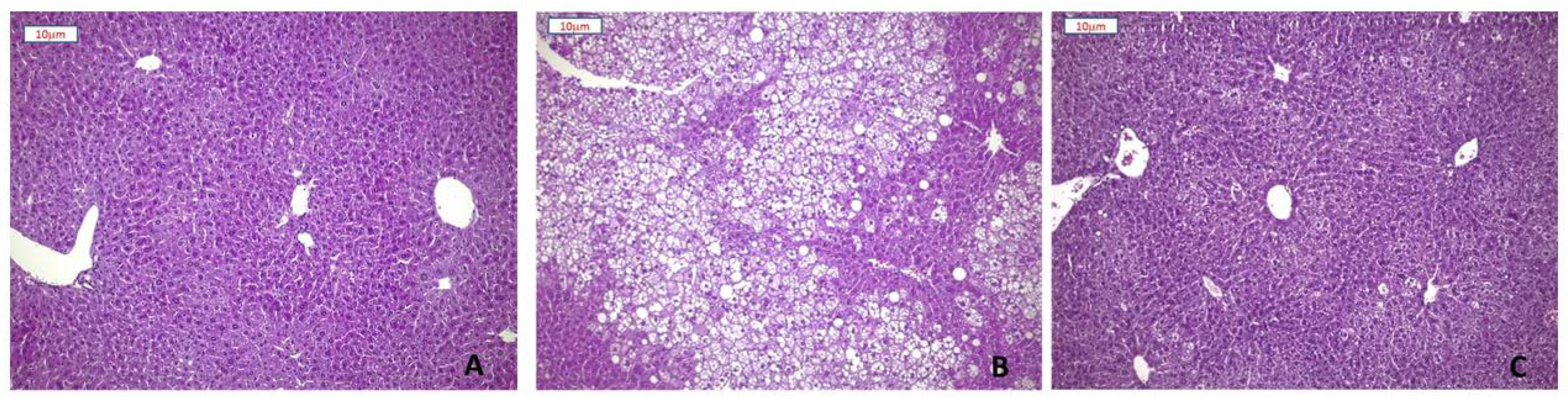 Nutrients 13 01281 g003 Nutrients 13 01281 g003