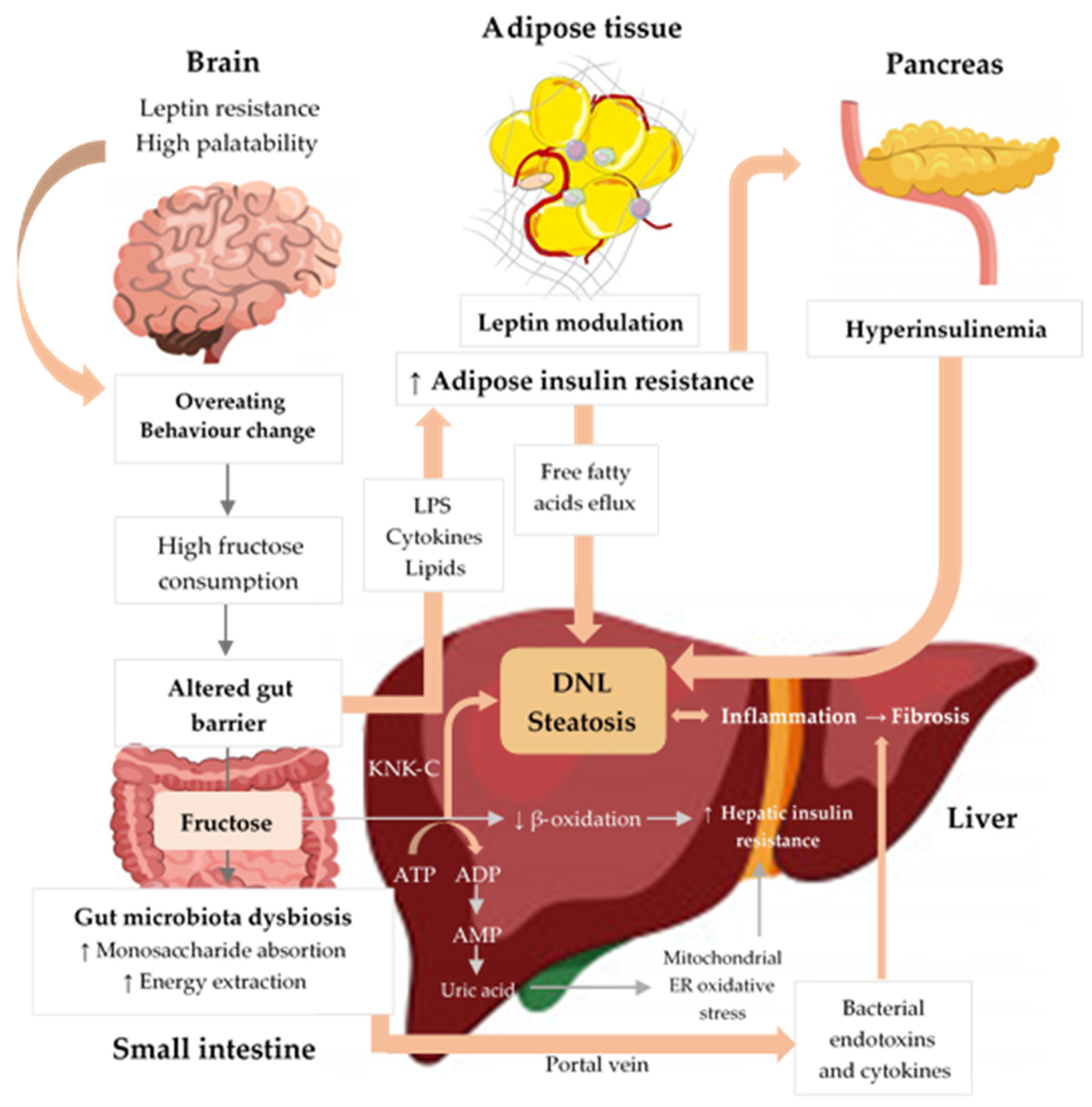 Nutrients | Free Full-Text | Overview of Non-Alcoholic Fatty Liver Disease  (NAFLD) and the Role of Sugary Food Consumption and Other Dietary  Components in Its Development | HTML