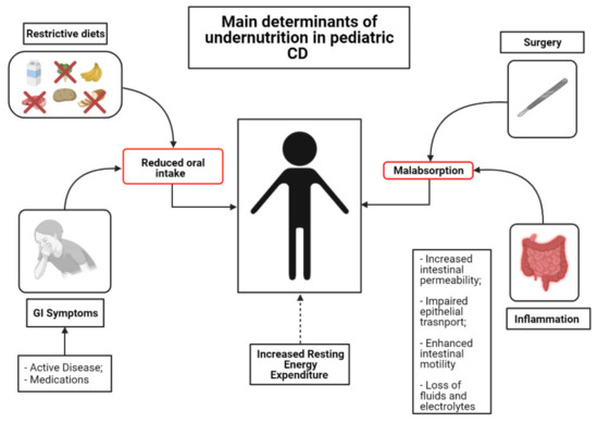Nutrients | Free Full-Text | Dietary Management in Pediatric Patients with Crohn's  Disease