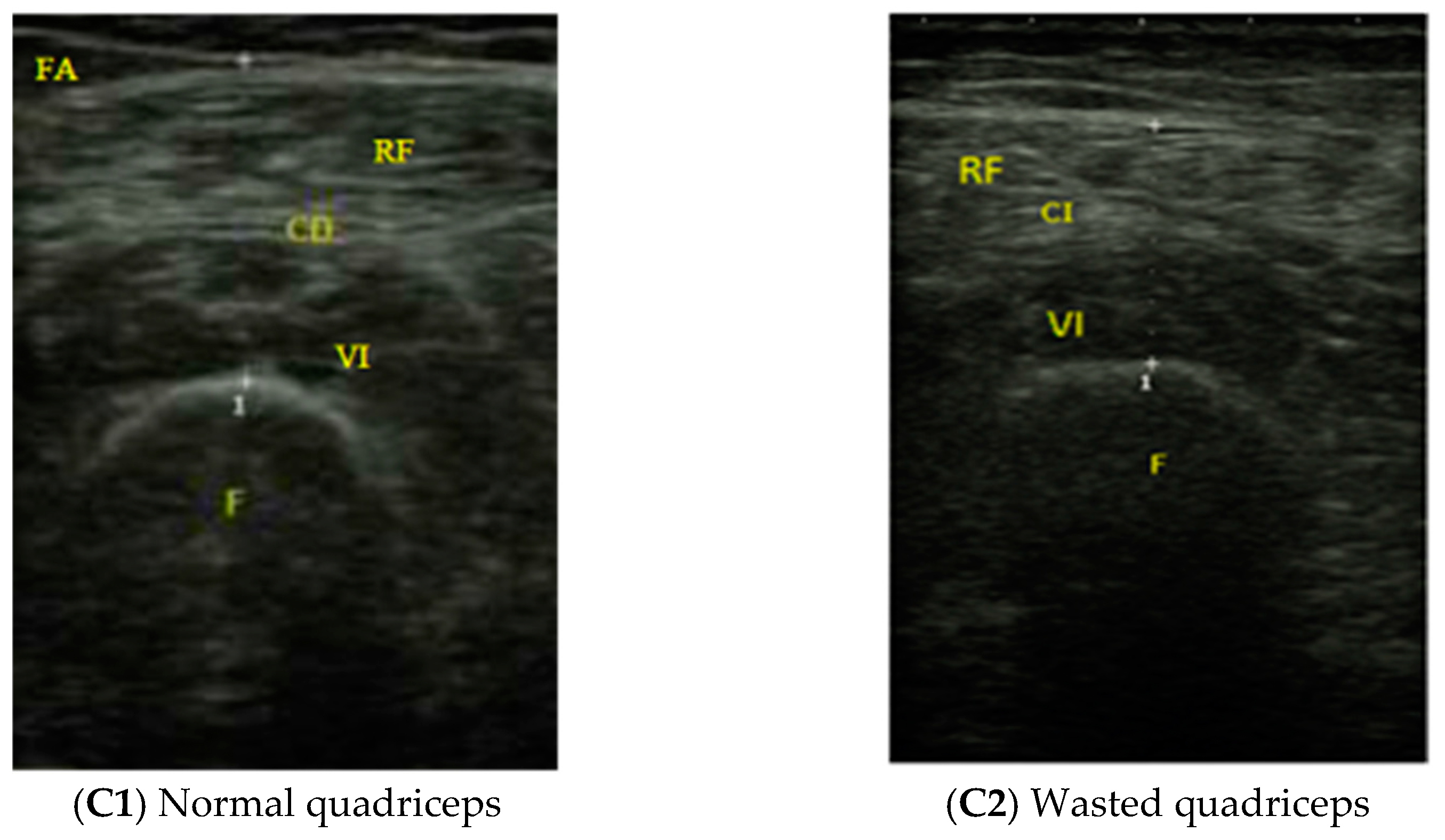 Nutrients 13 02401 g001b