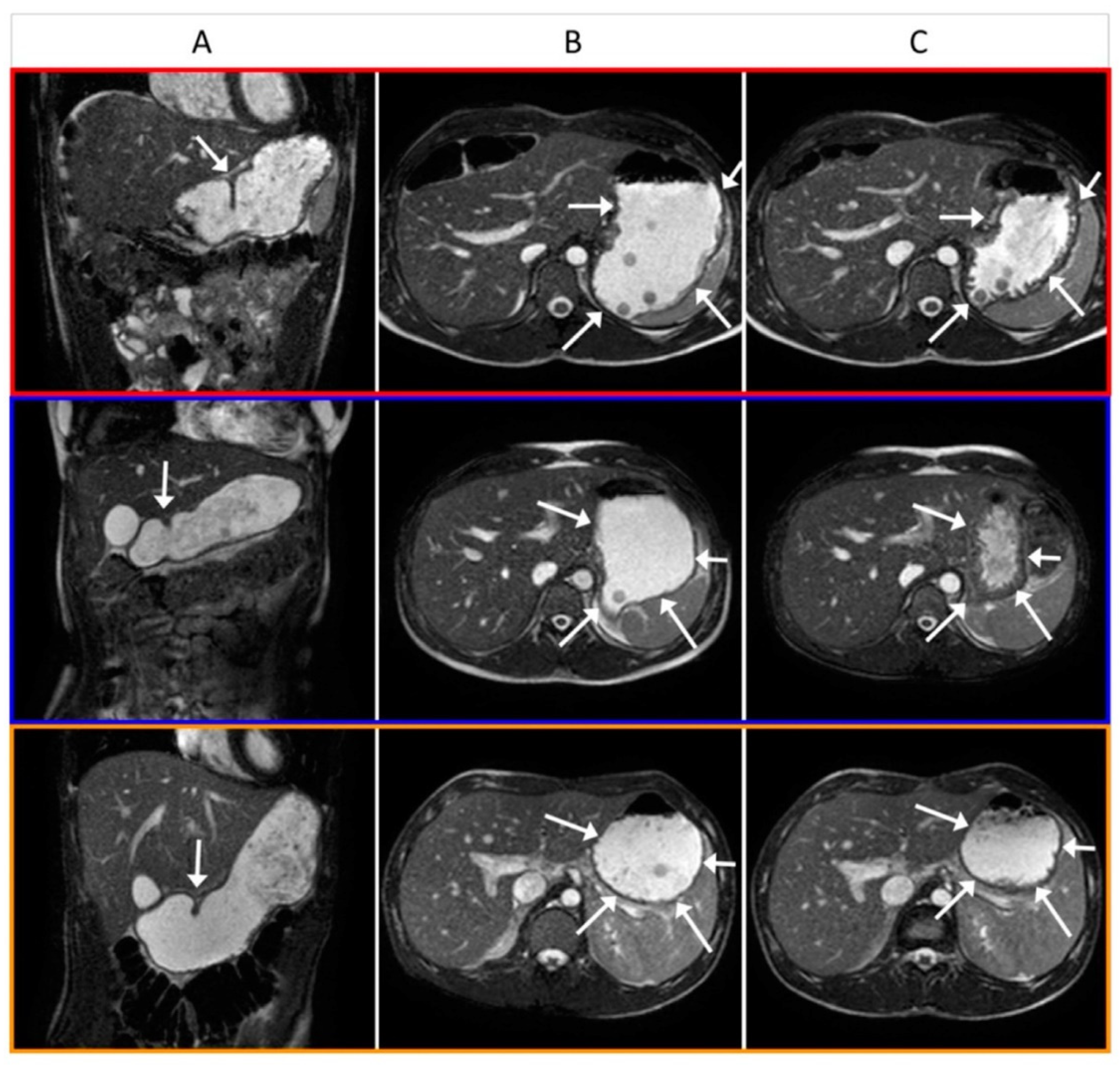 Nutrients 14 01321 g004 Nutrients 14 01321 g004