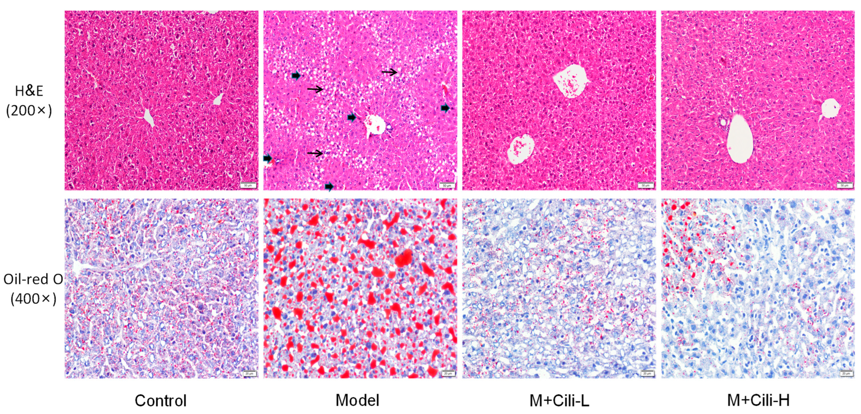 Nutrients Free Full Text Rna Seq Analysis Of Protection Against Chronic Alcohol Liver Injury By Rosa Roxburghii Fruit Juice Cili In Mice Html