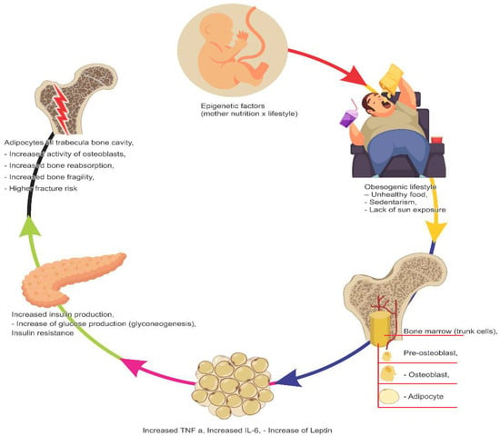 Understanding How Obesity Affects Bone Health and Risk of Fractures -  Obesity Action Coalition