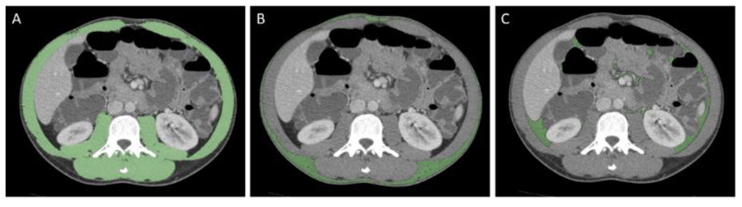 Nutrients 14 03460 g001 Nutrients 14 03460 g001