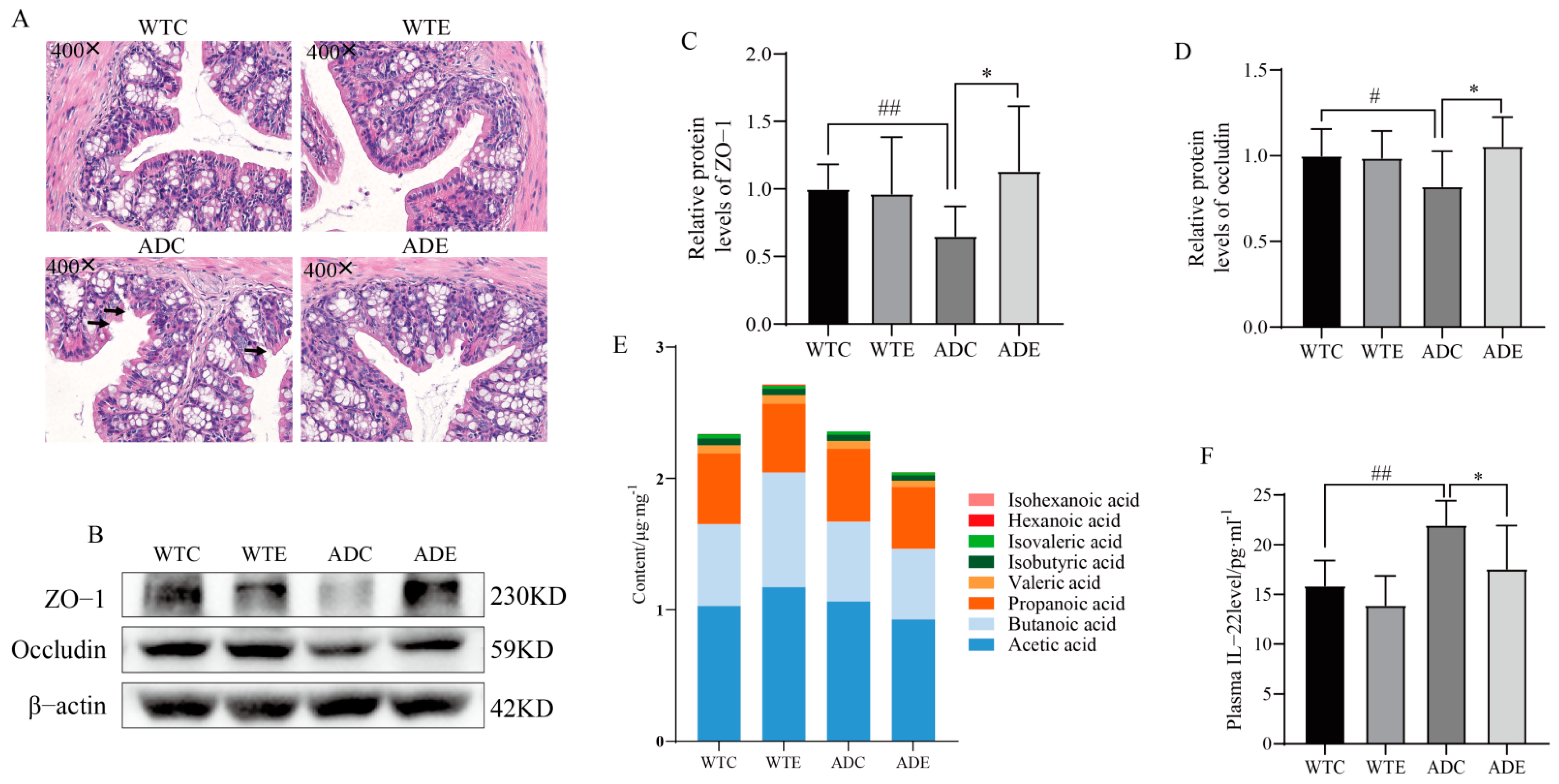 Nutrients 14 04134 g005 Nutrients 14 04134 g005