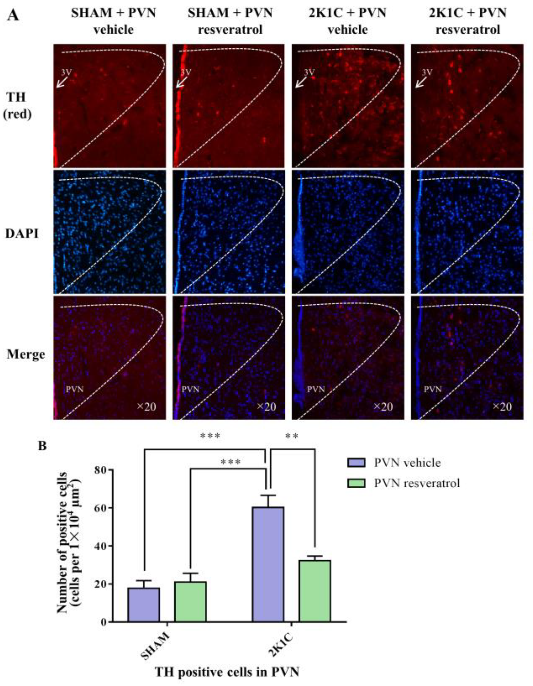 Nutrients 14 04177 g007 Nutrients 14 04177 g007