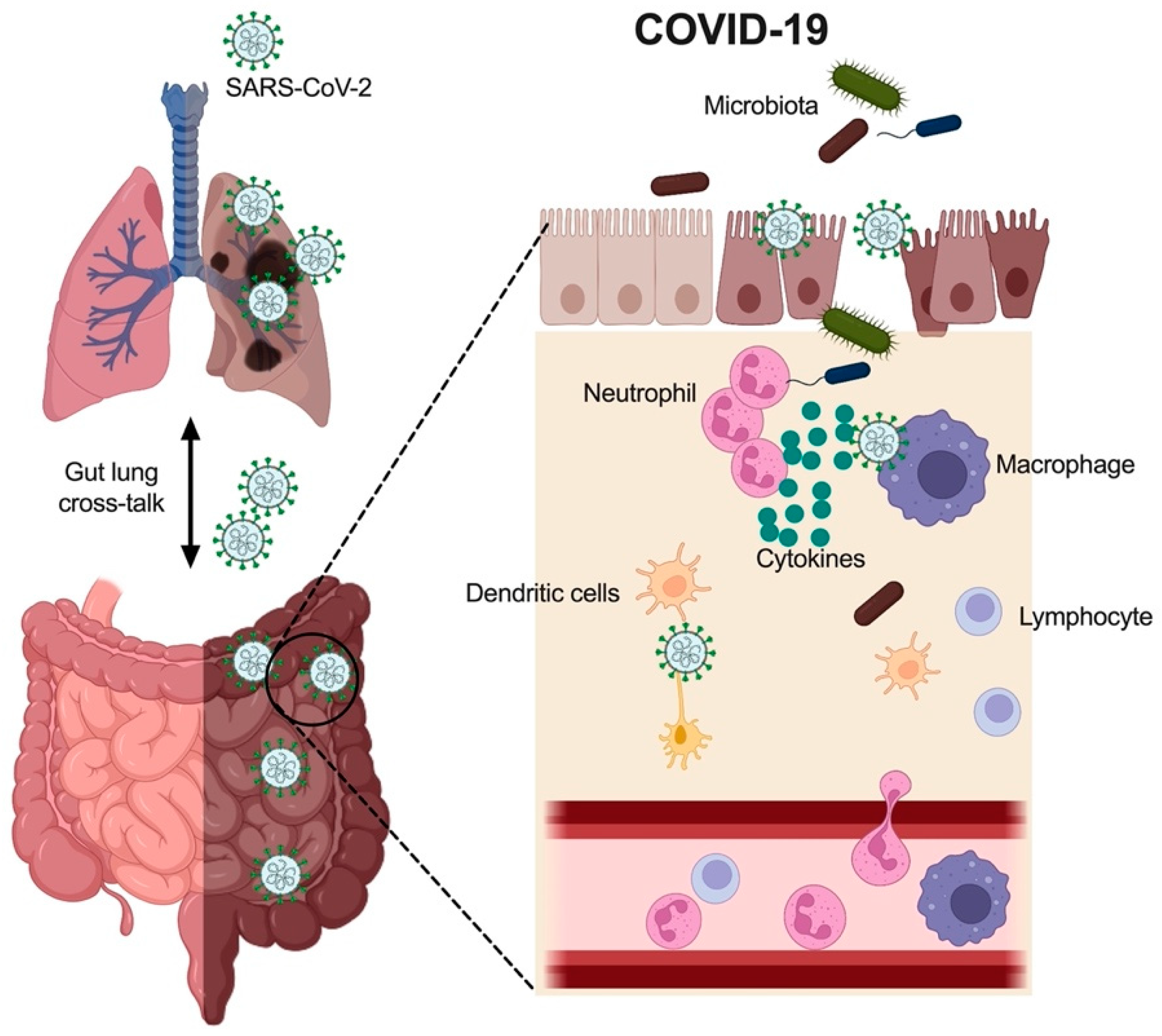 Nutrients | Free Full-Text | COVID-19 and Gut Injury | HTML