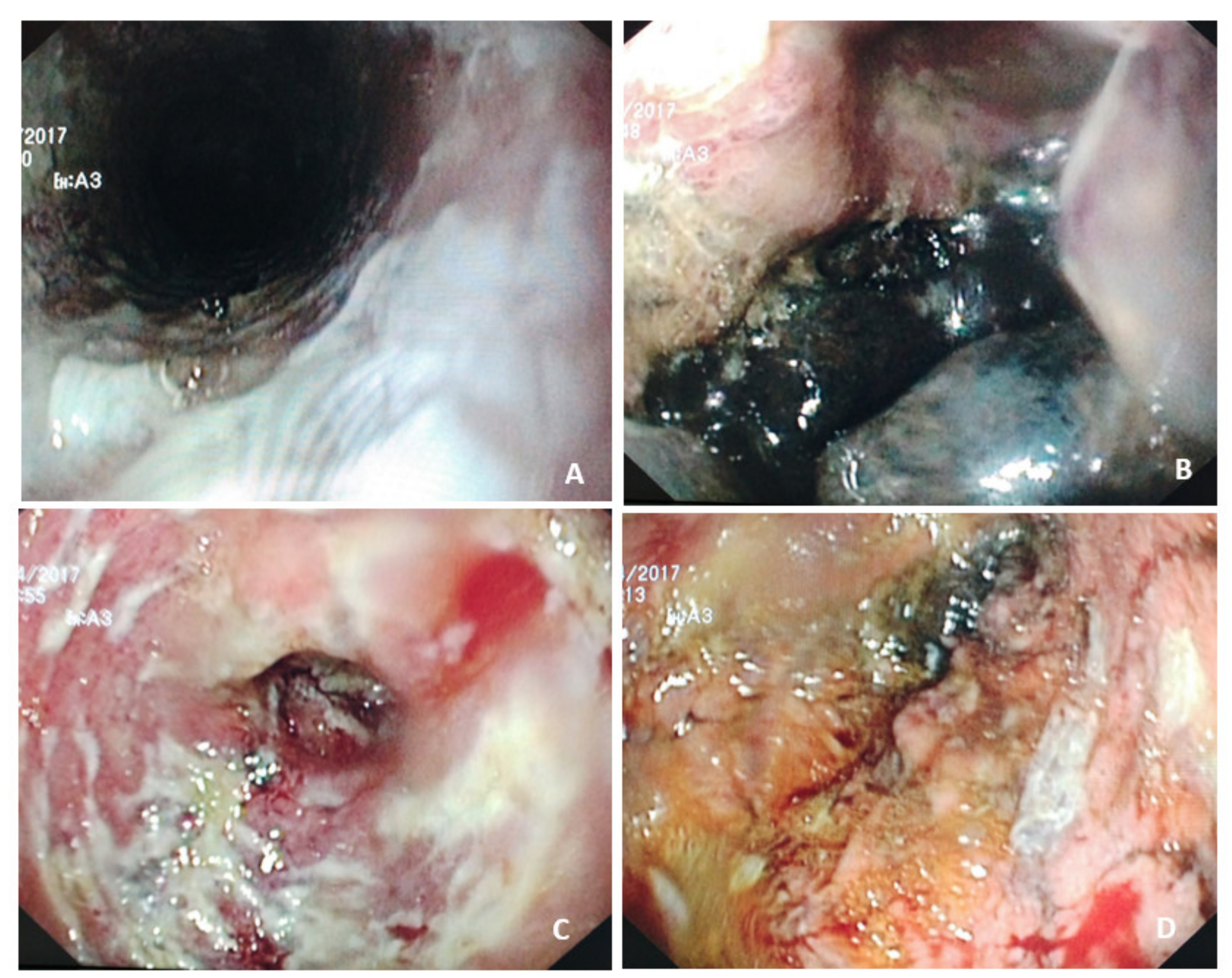 Nutrients 14 04819 g005 Nutrients 14 04819 g005