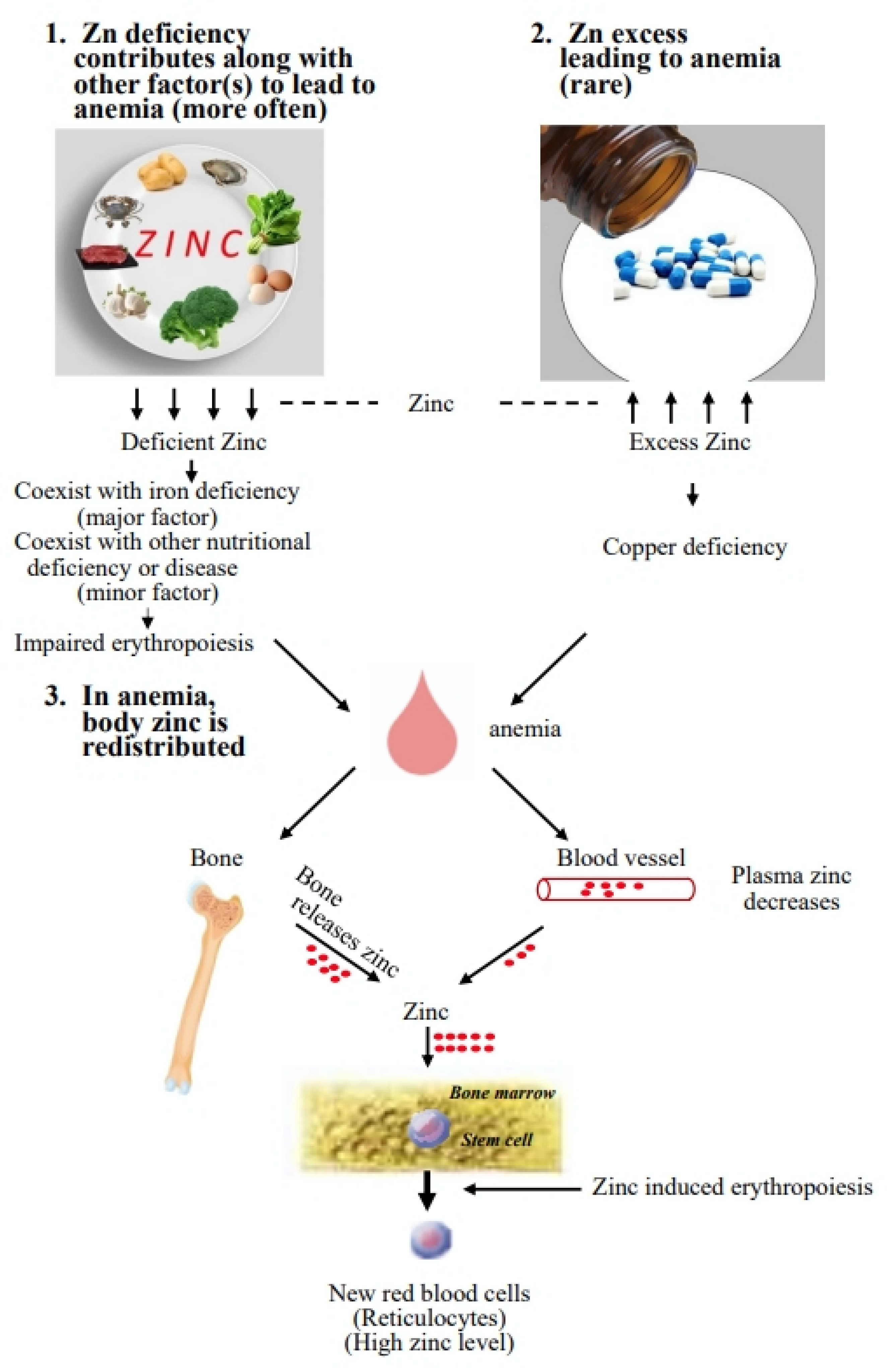 Nutrients | Free Full-Text | Association of Zinc with Anemia