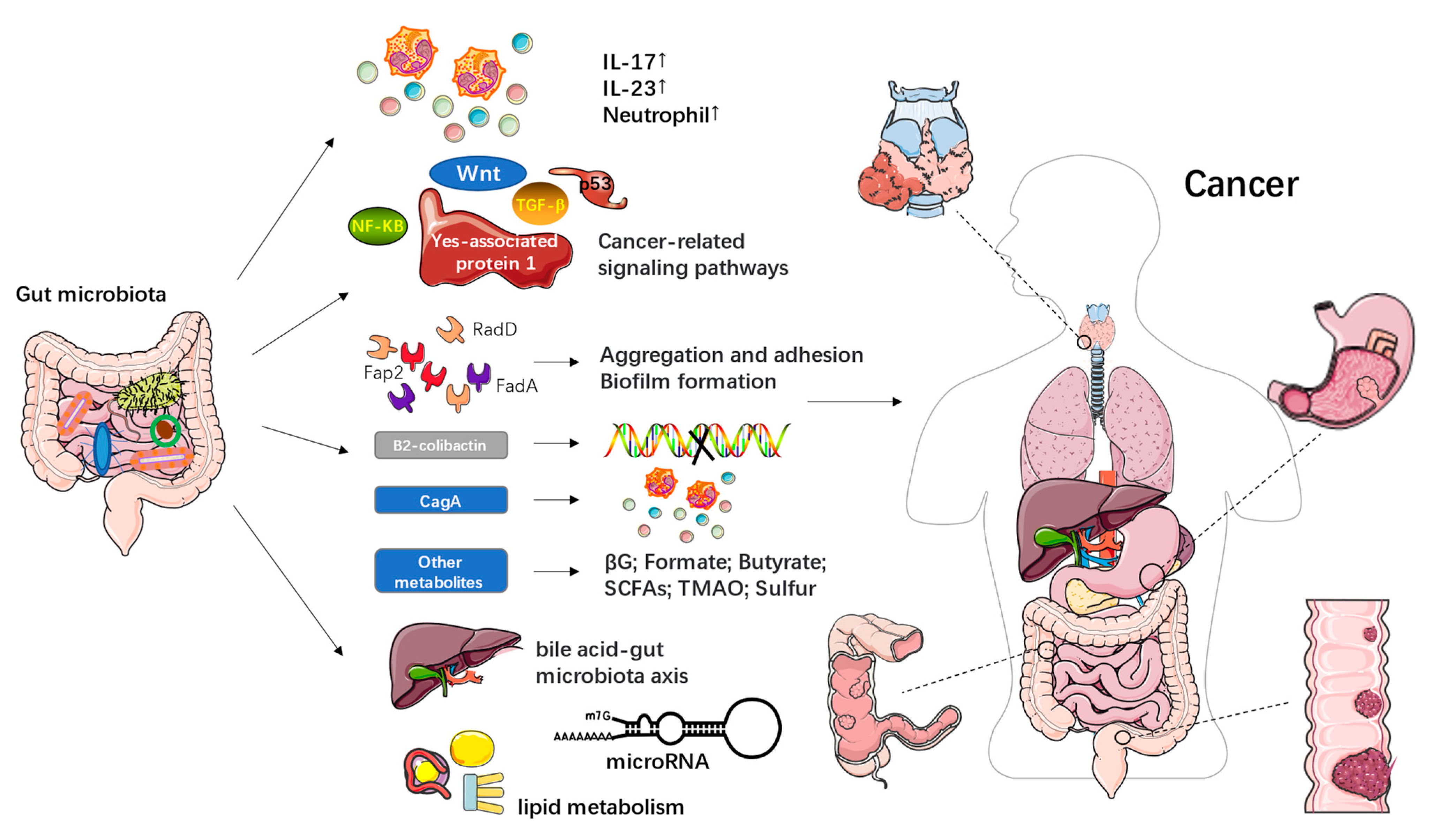 Frontiers  The role of microbiomes in gastrointestinal cancers: new  insights