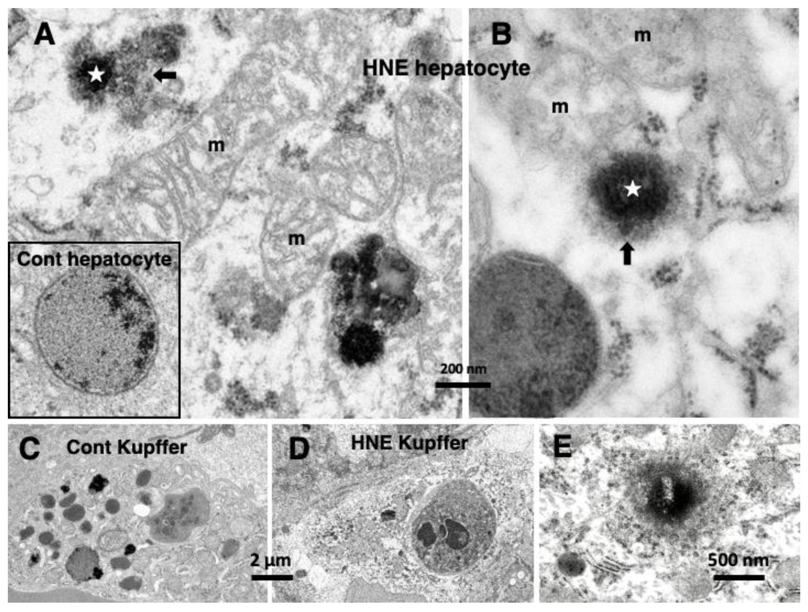 Nutrients 15 00609 g004 Nutrients 15 00609 g004