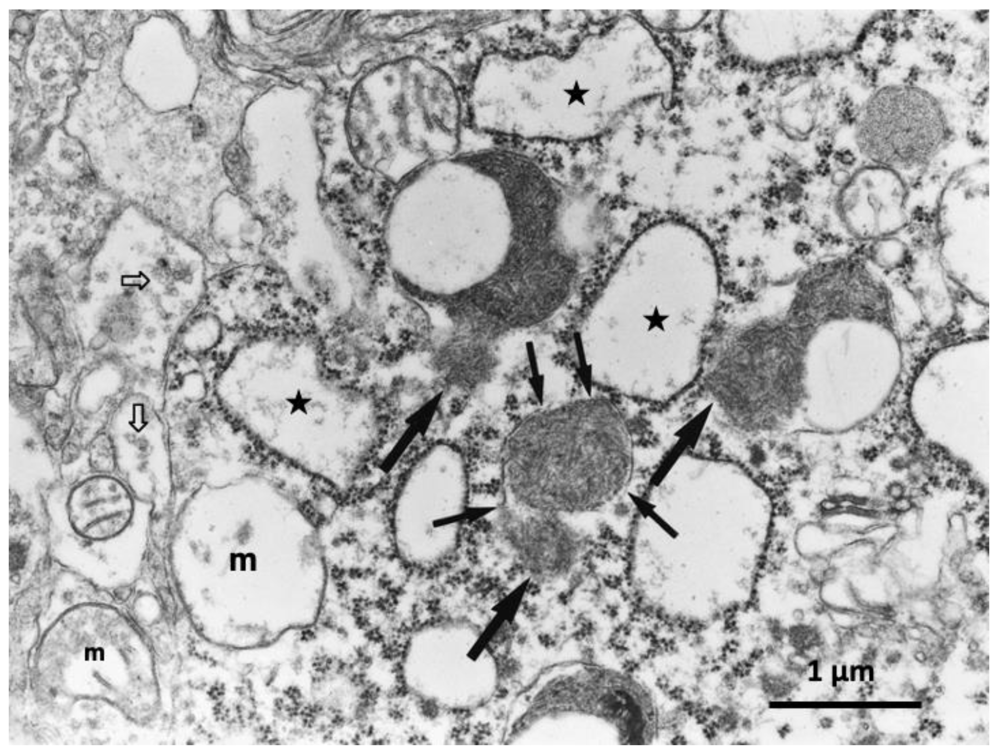 Nutrients 15 00609 g006 Nutrients 15 00609 g006