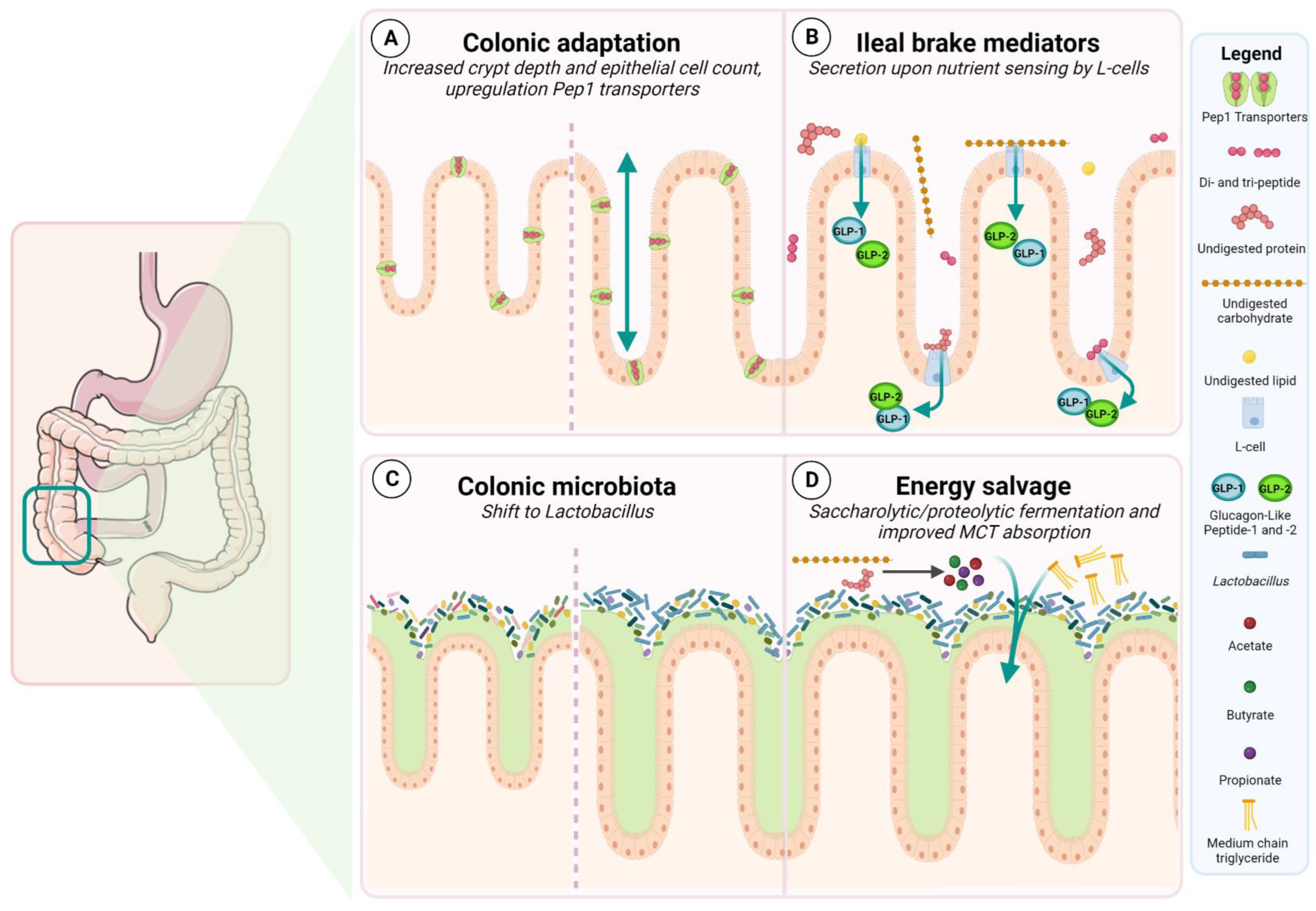 Nutrients | Free Full-Text | The Role of a Colon-in-Continuity in 