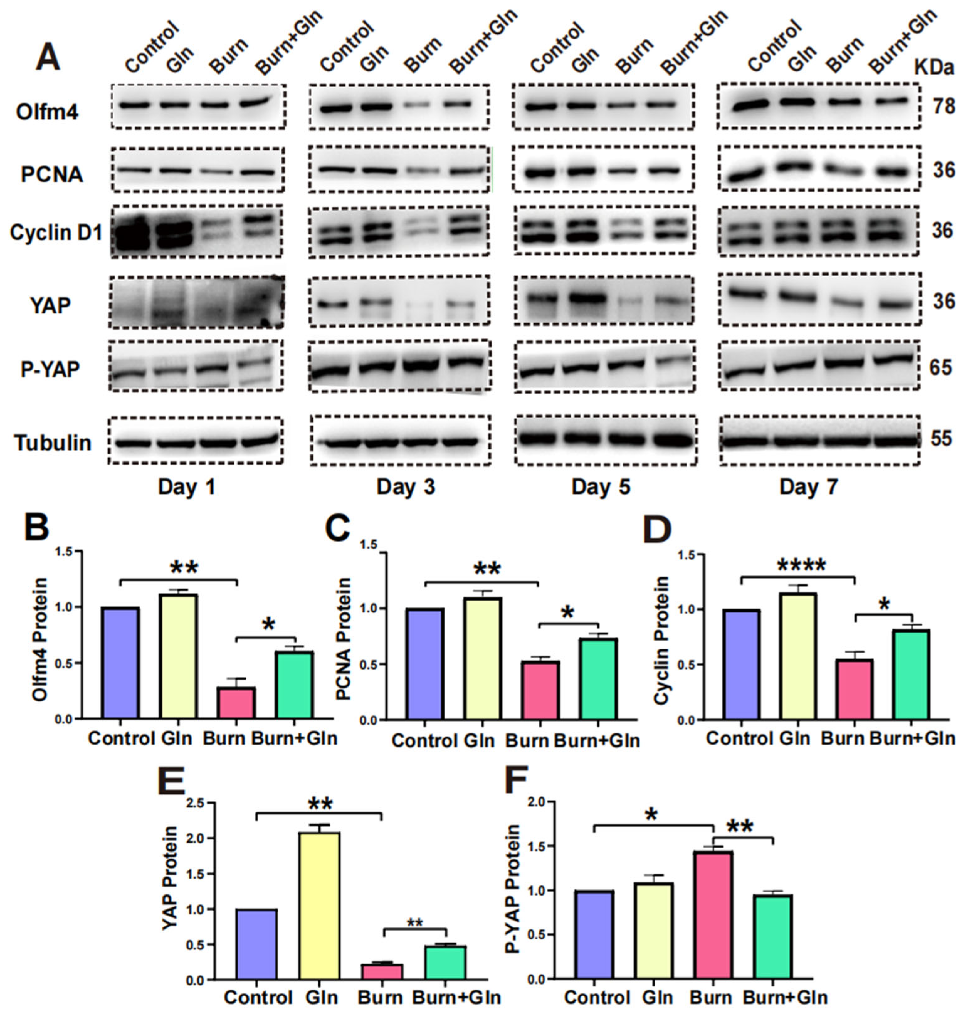 Nutrients 15 01766 g008 Nutrients 15 01766 g008