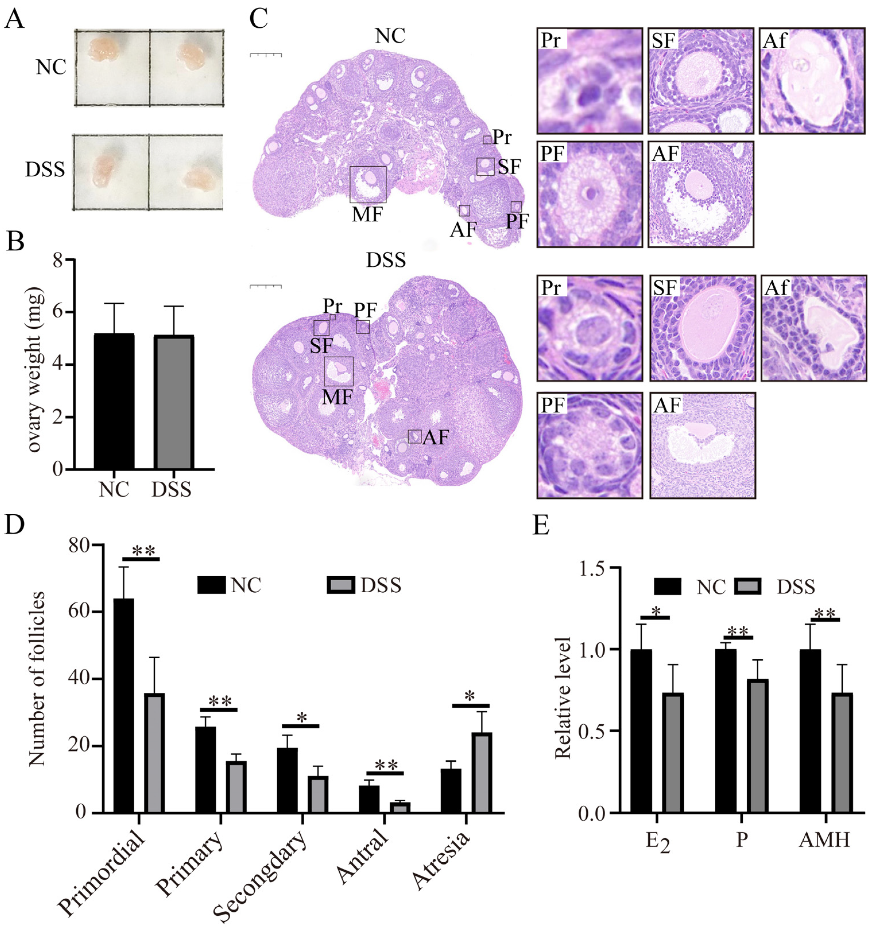 Nutrients 15 02425 g005 Nutrients 15 02425 g005